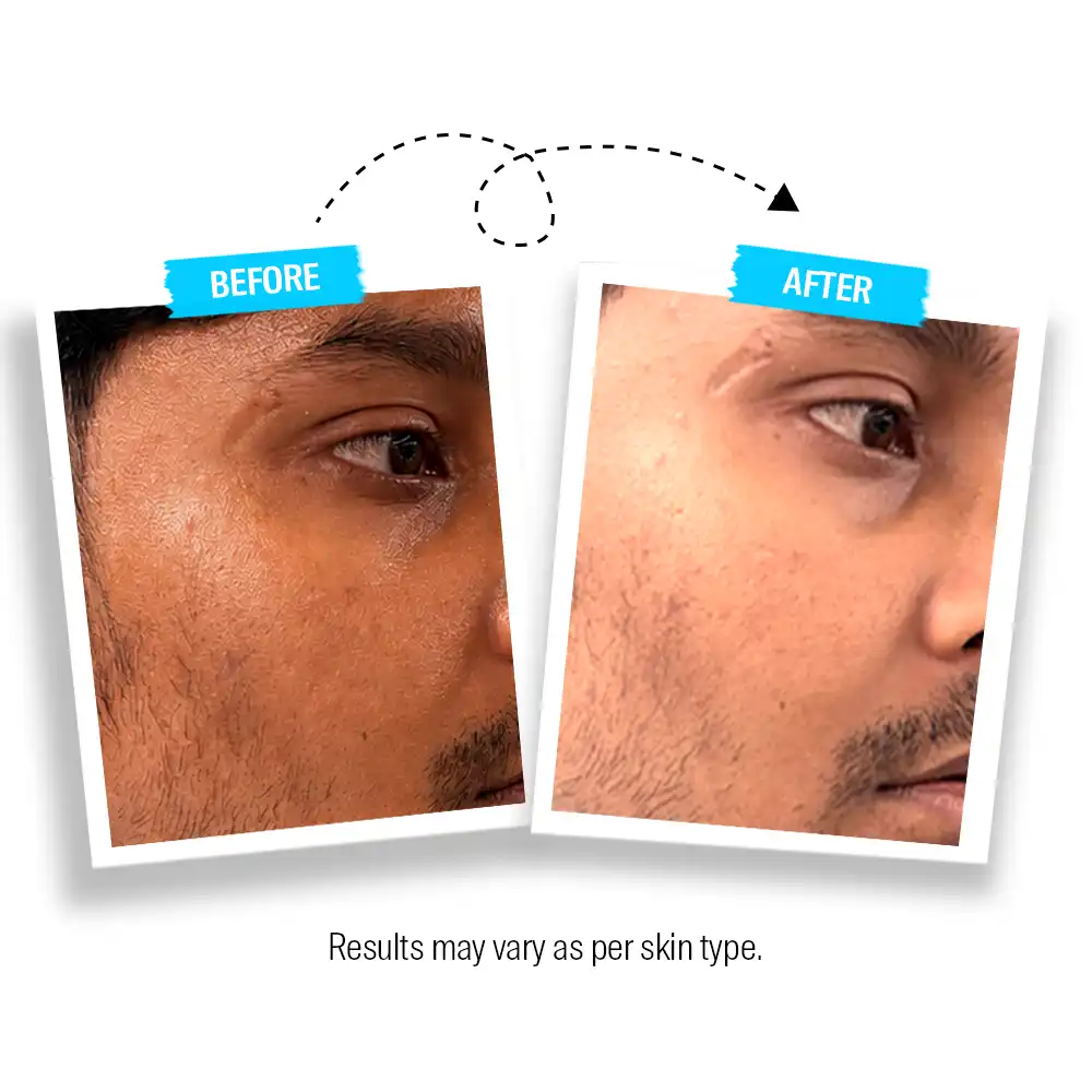 2in1 Oil Control and Brightening Face Serum - Image 6