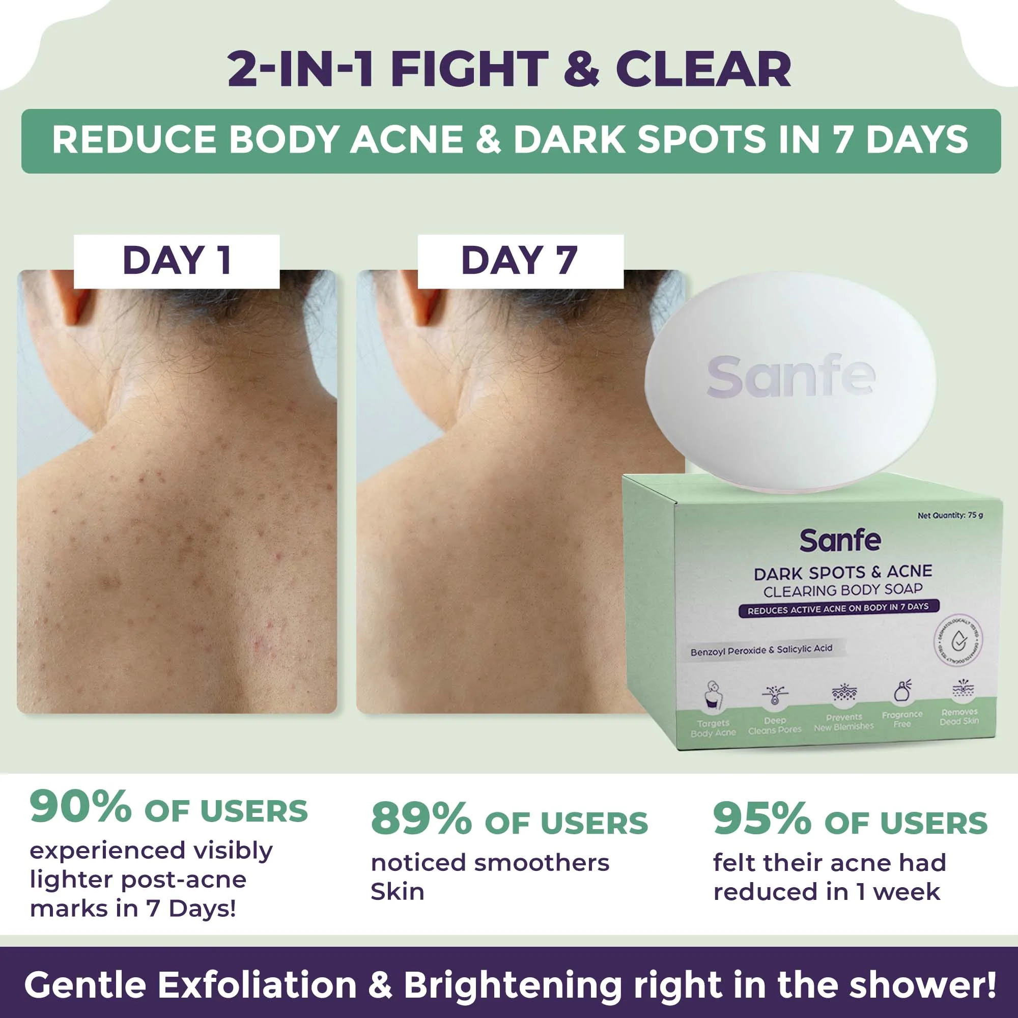 Acne Clearing Soap - Image 3