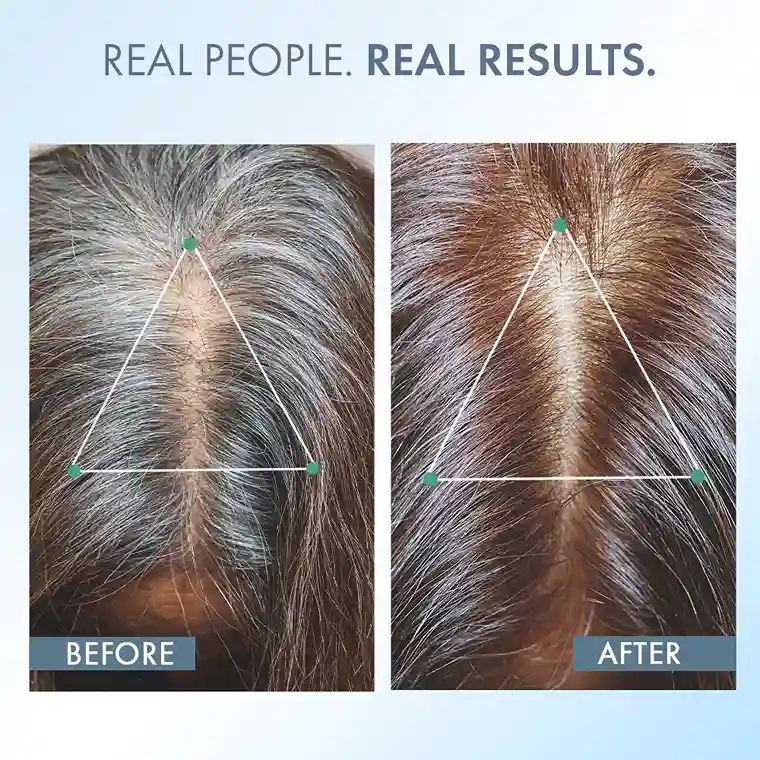 Anti-Grey Hair Prime Serum, 50 ml + Supplements 30N - Image 11