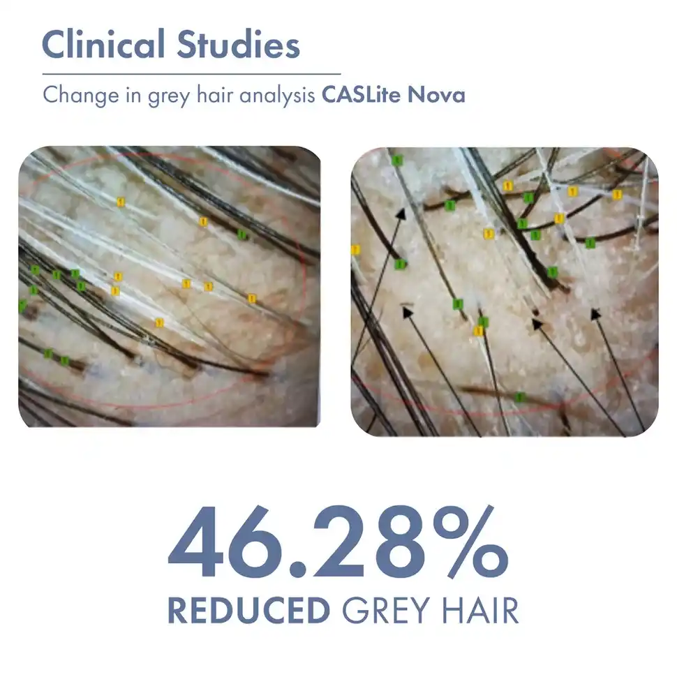 Anti-Grey Hair Prime Serum, 50ml - Image 5