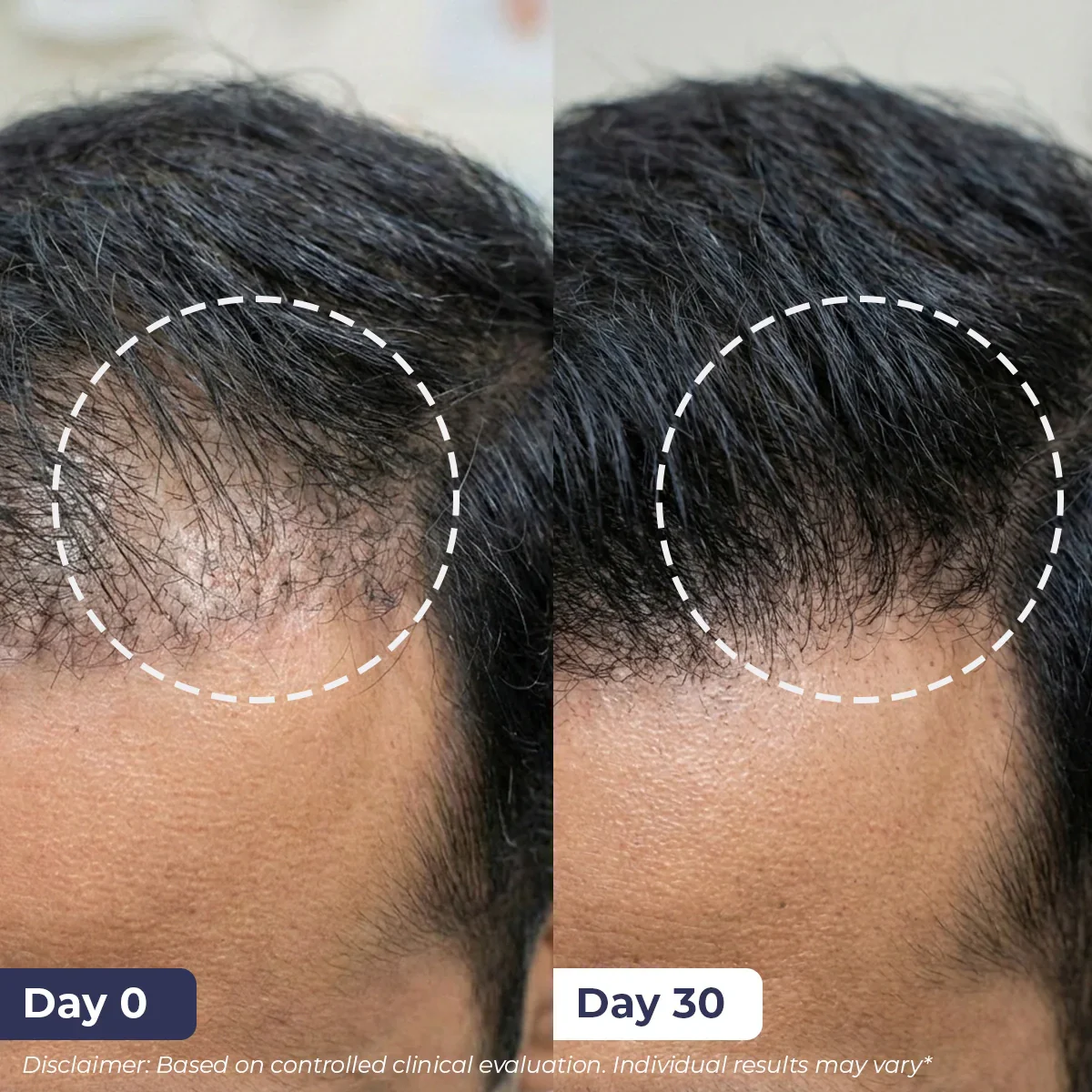 Anti-Hairfall Shampoo | 200 ml | Flash Sale - Image 5
