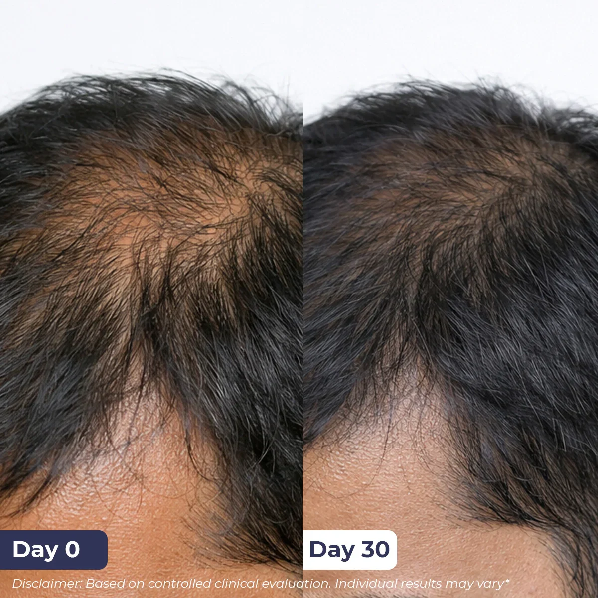 Anti-Hairfall Spray | 200 ml - Image 5