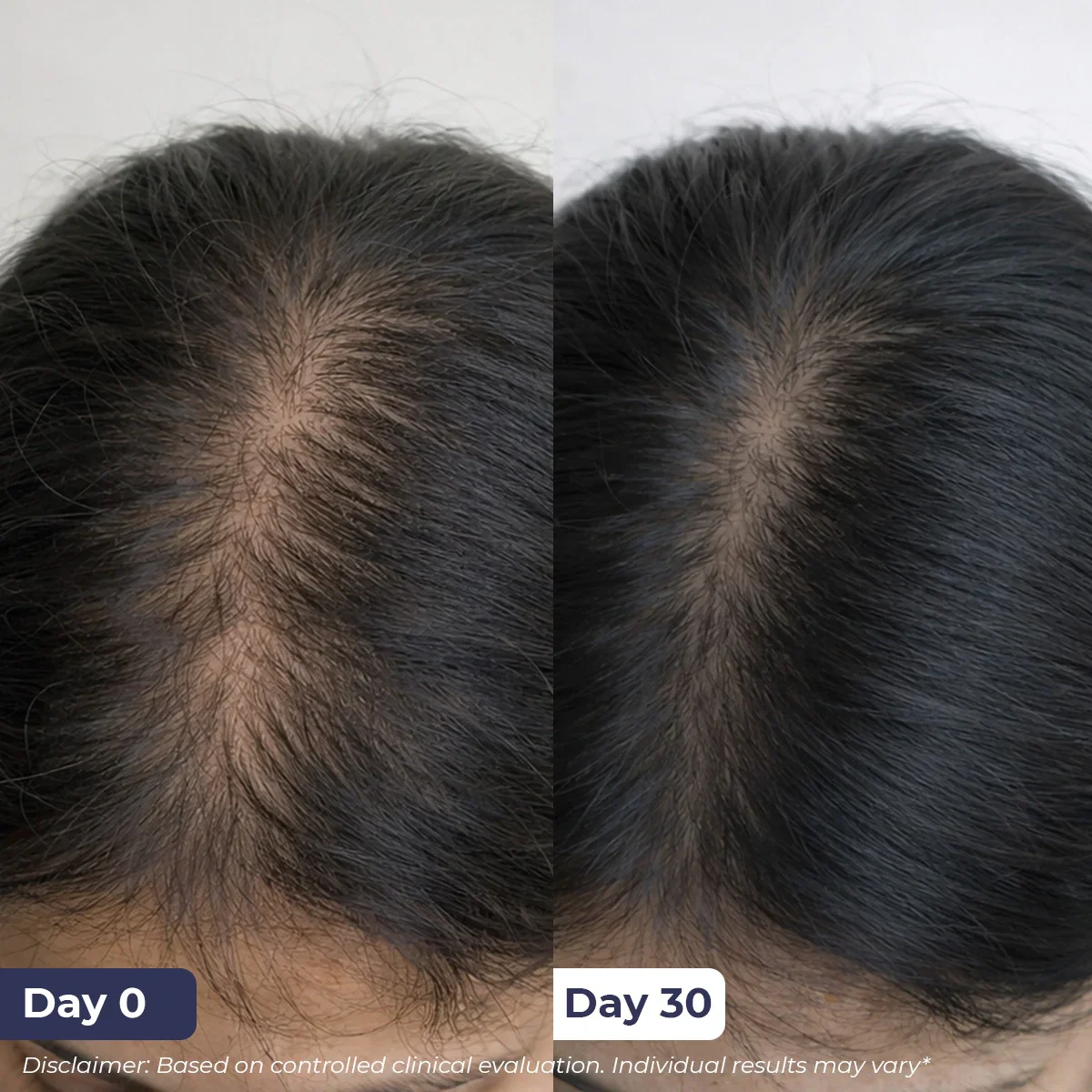 Anti-Hairfall Spray | 200 ml - Image 6