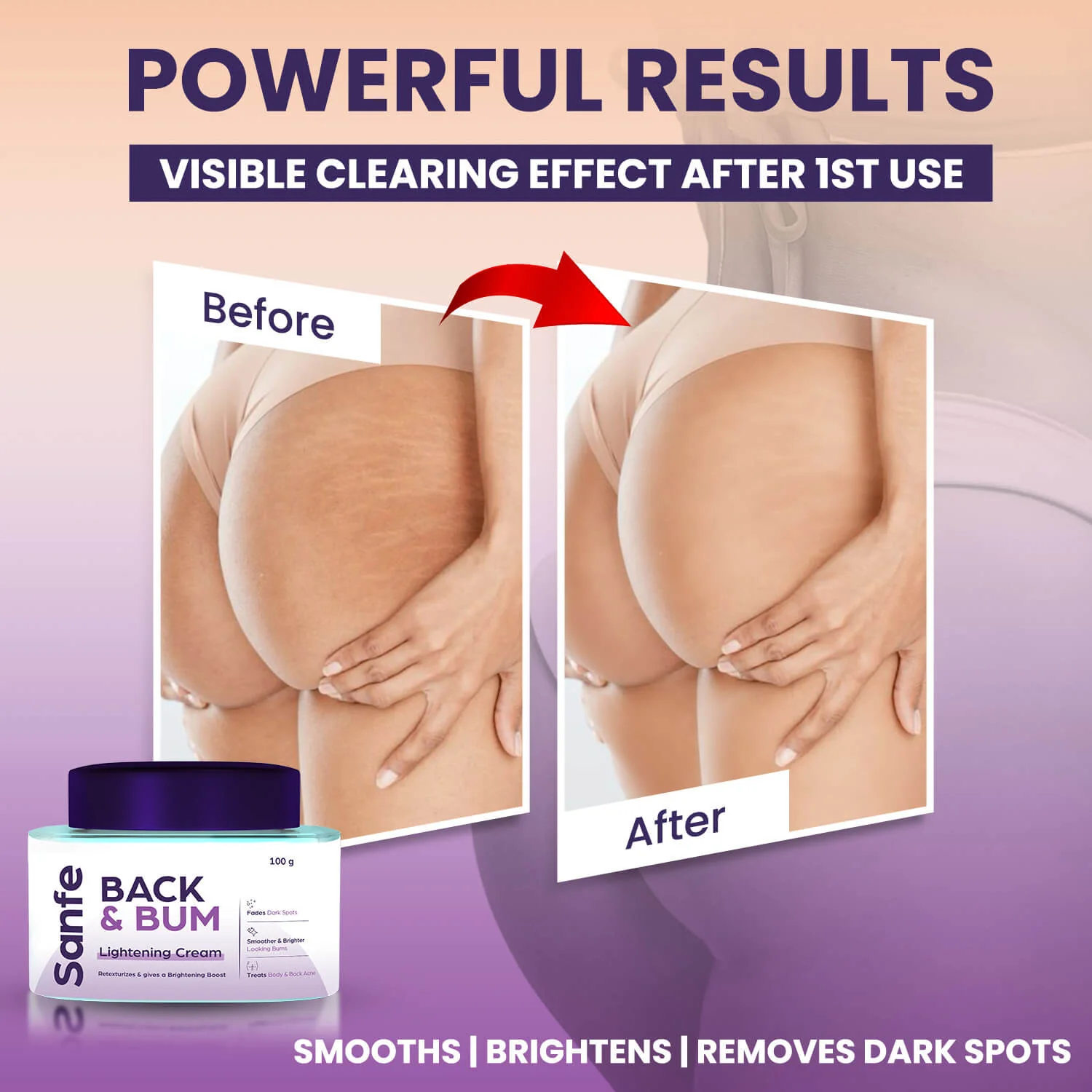 Back and Bum lightening Cream - 100gm (Pack of 3) - Image 4