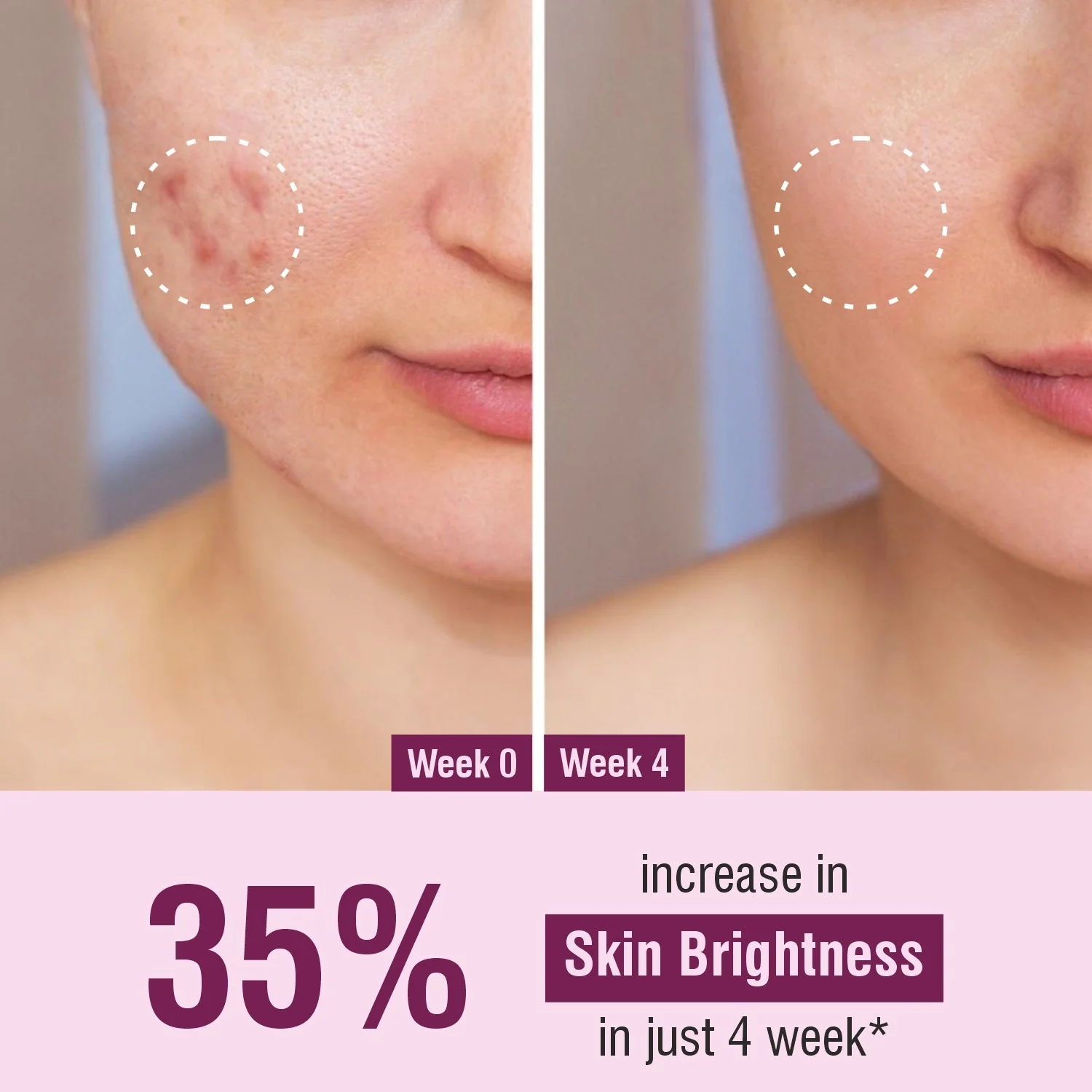 Bhoomi Herbal India Retinol + Niacinamide Face Cream (50gm)- Pack of 2 - Image 4