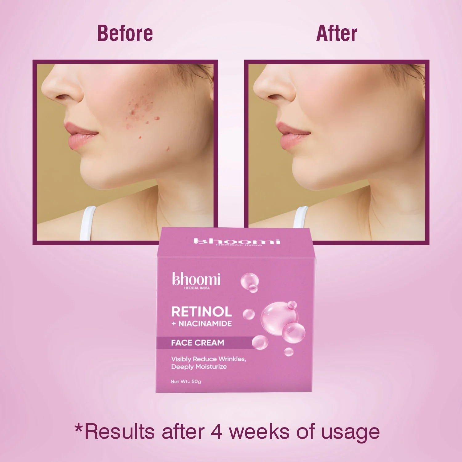 Bhoomi Herbal India Retinol + Niacinamide Face Cream (50gm)- Pack of 2 - Image 8