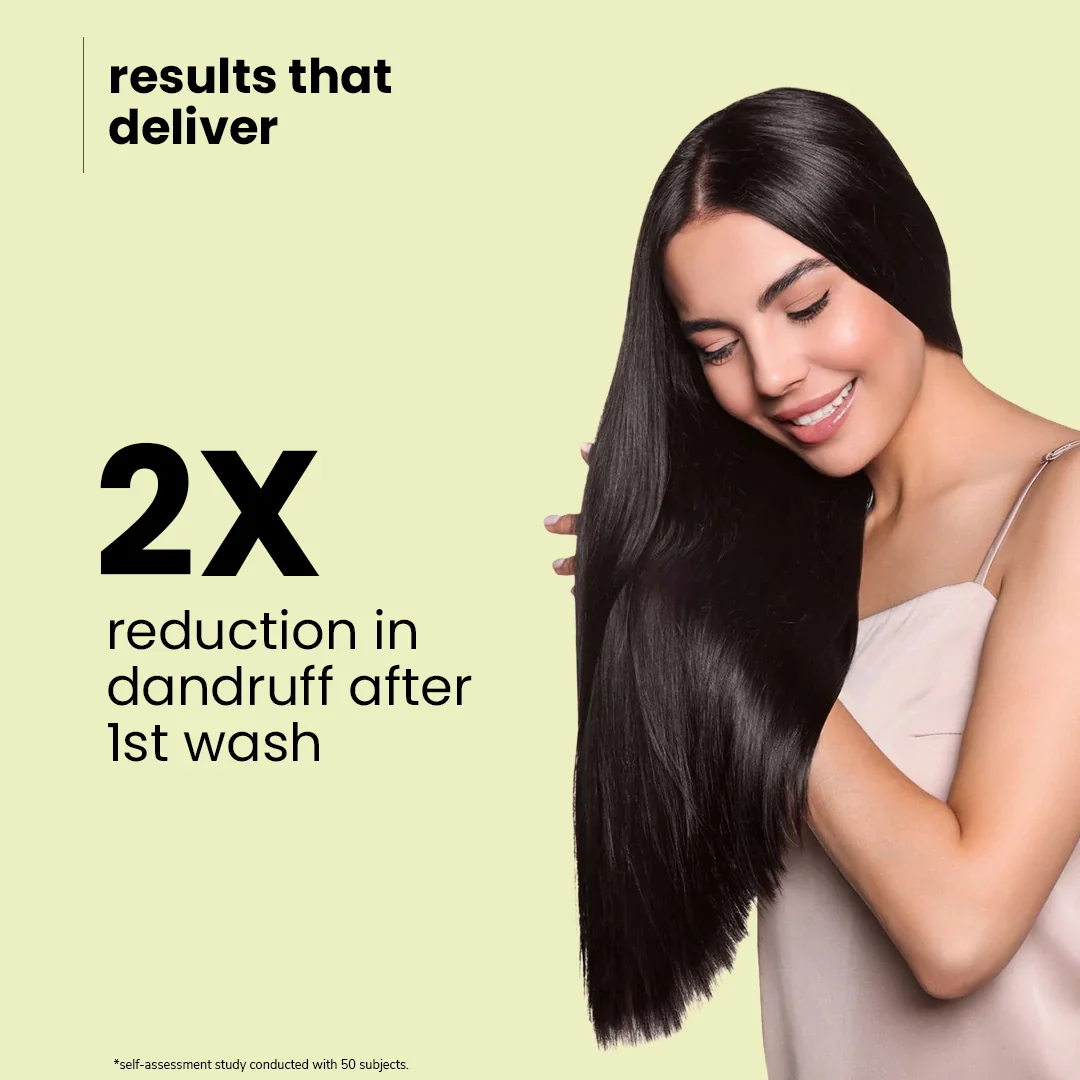 Botanic Balance Anti-Dandruff Shampoo – Natural Dandruff Fighter with Sitafal Extract | 100 ml | 200 ml - Image 6