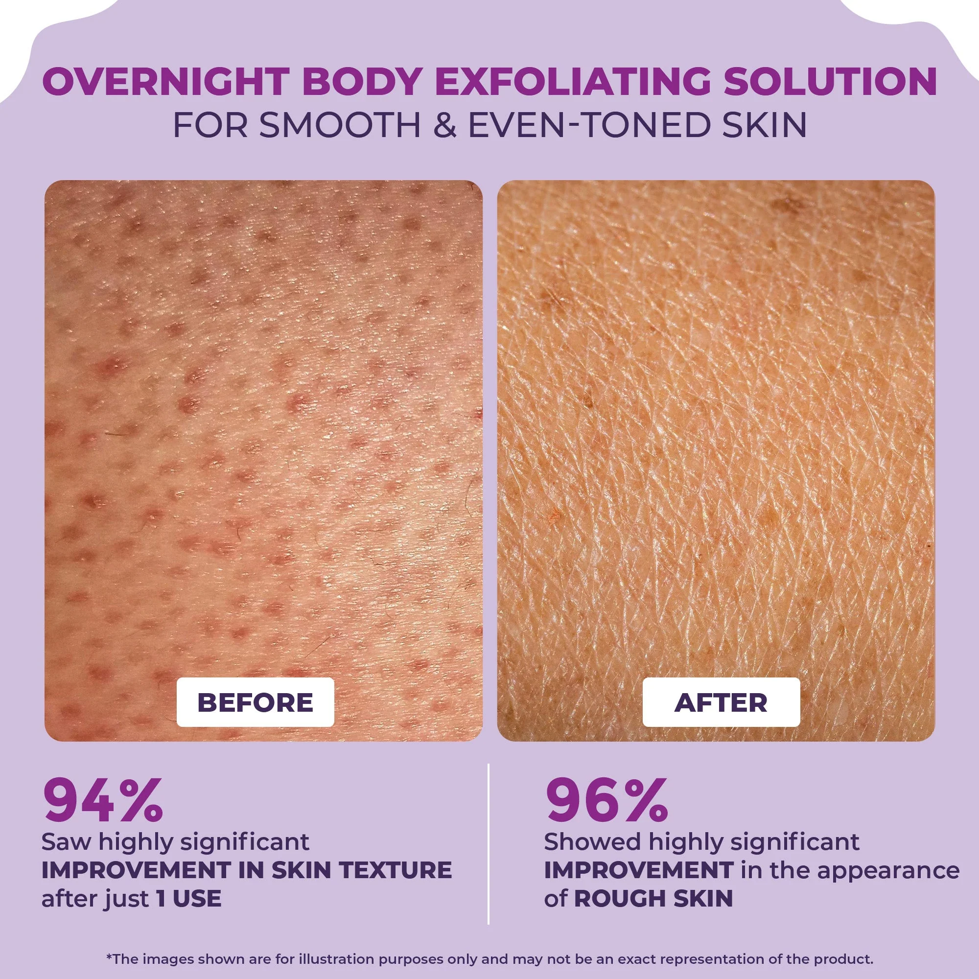 Clear & Confident Overnight Glow Body Cream for Face - Image 3