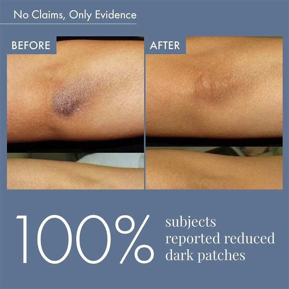 Dark Patches Corrector for Men & Women, 100ml - Image 6