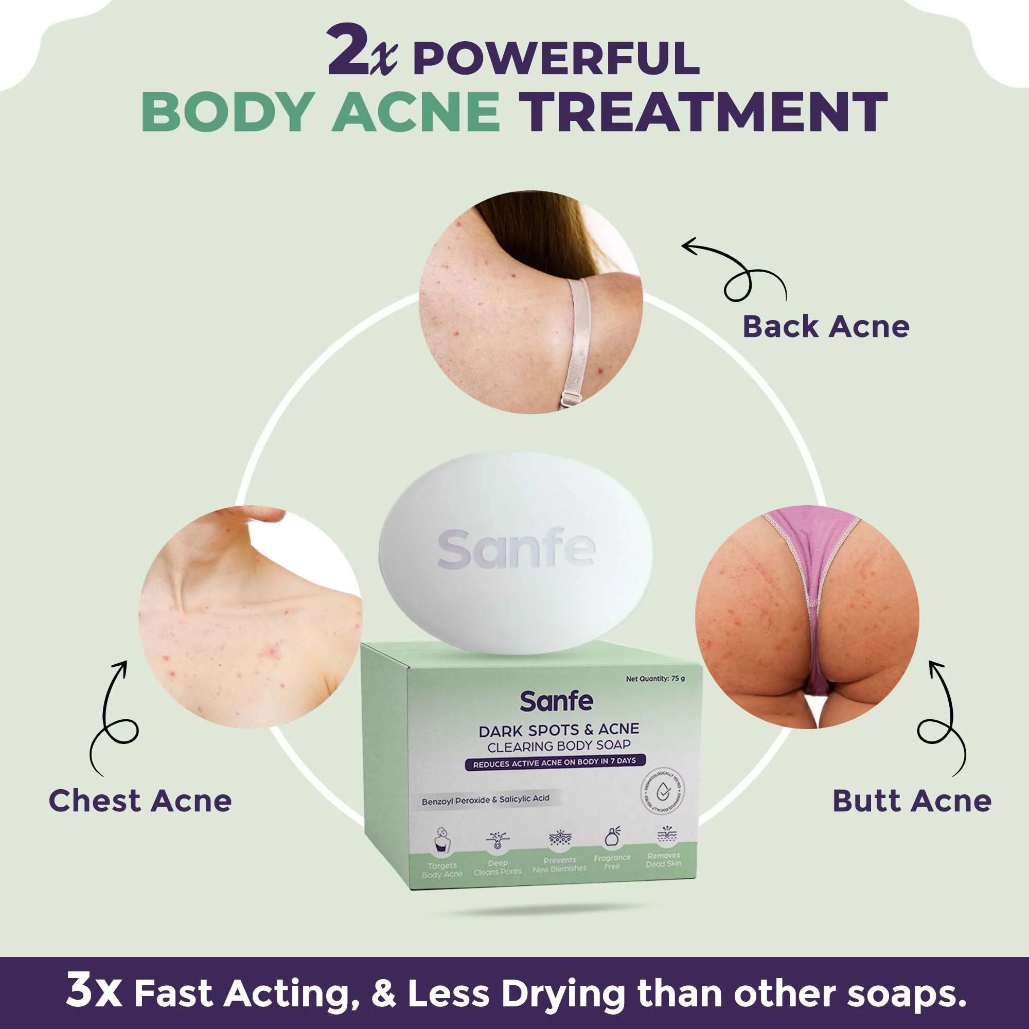 Dark Spots & Acne Clearing Body Soap – Pack of 4 - Image 5