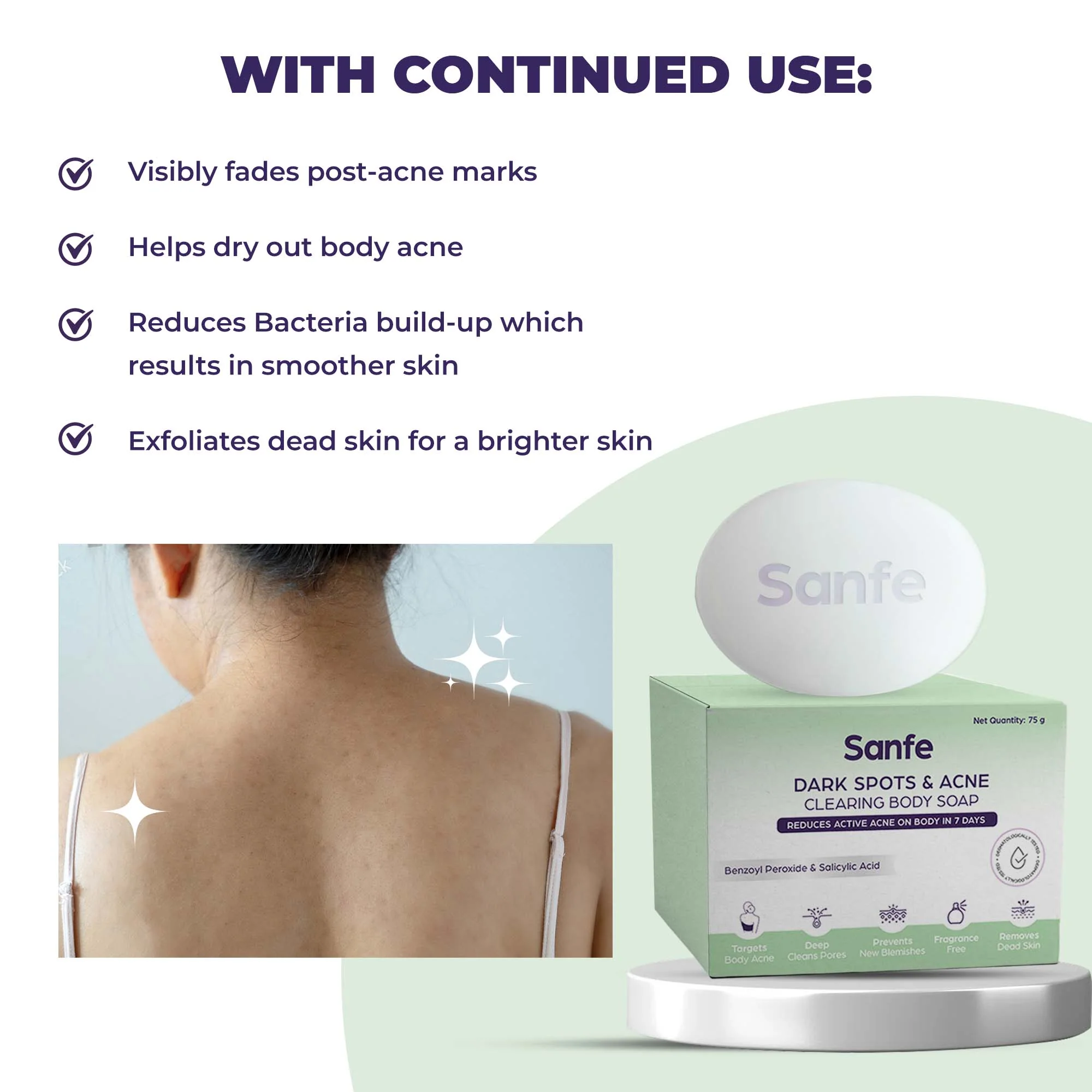 Dark Spots & Acne Clearing Body Soap – Pack of 4 - Image 7