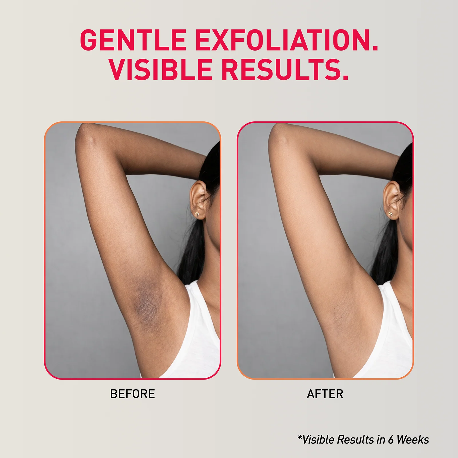 Depigmentation Underarm Mist - Image 4