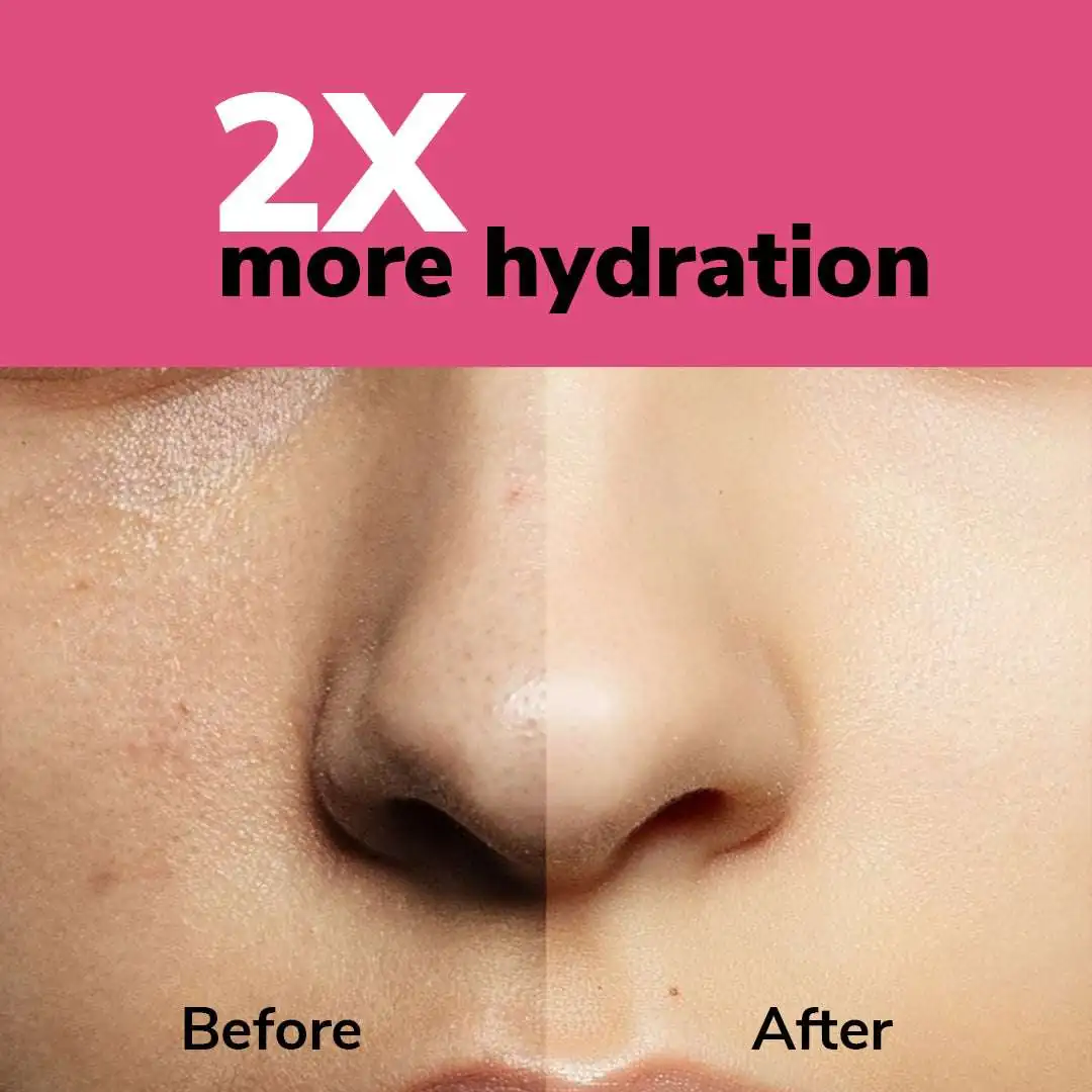 Dry Skin Combo – Deep Hydration & Nourishing Care Kit - Image 15