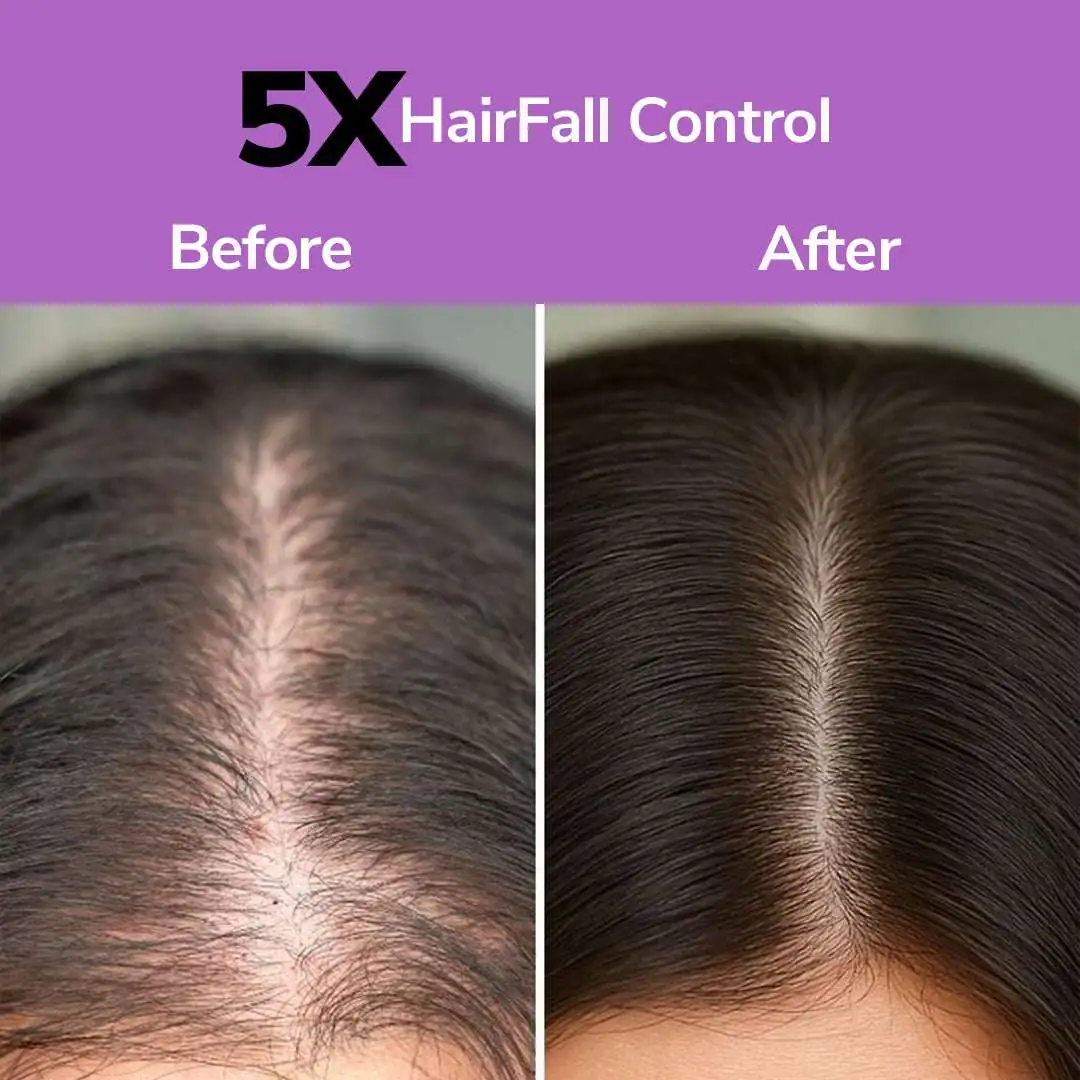 FreshLuxe Anti-Hairfall & Strengthening Combo | Rice Water & Onion Rosemary 200ml - Image 2