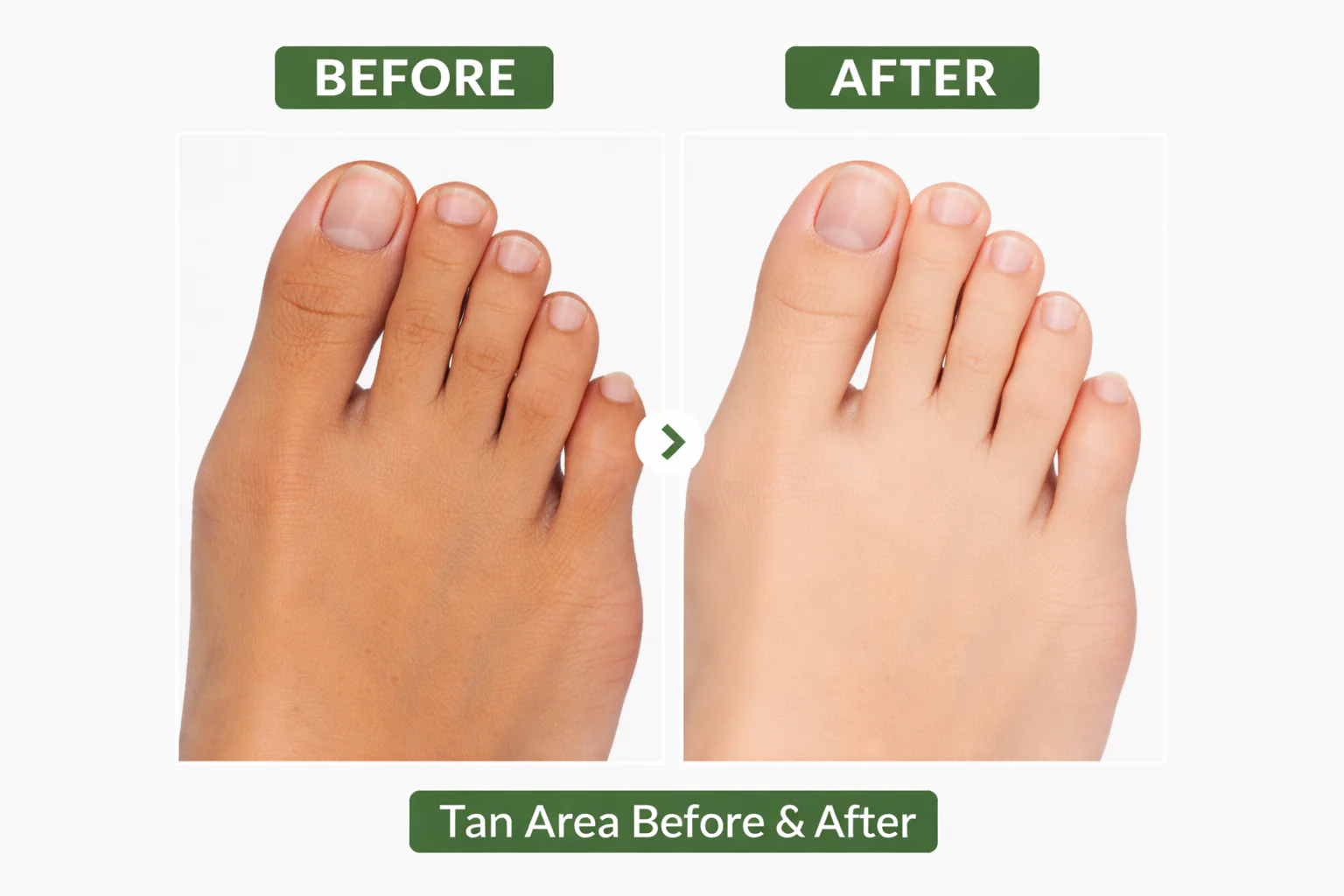 Gloweza De Tan Face Pack for Tan Removal - 100g - Image 6