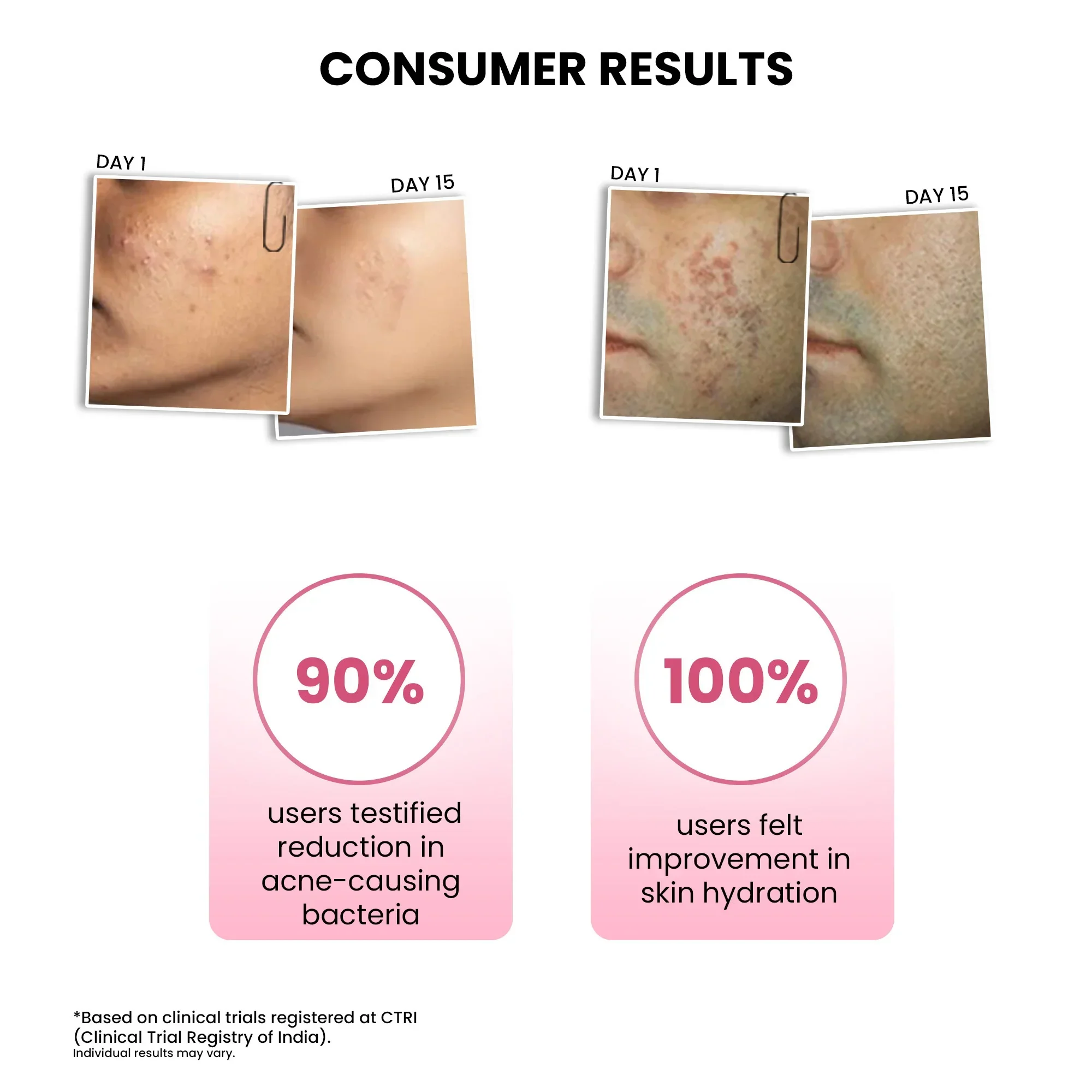 Goodbye Acne Cleanser (25ml) + ThriveCo Goodbye Acne Serum (10ml) - Image 6