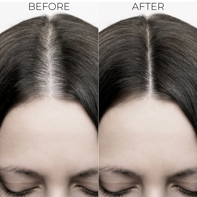 Hair Fall Control kit - Image 4