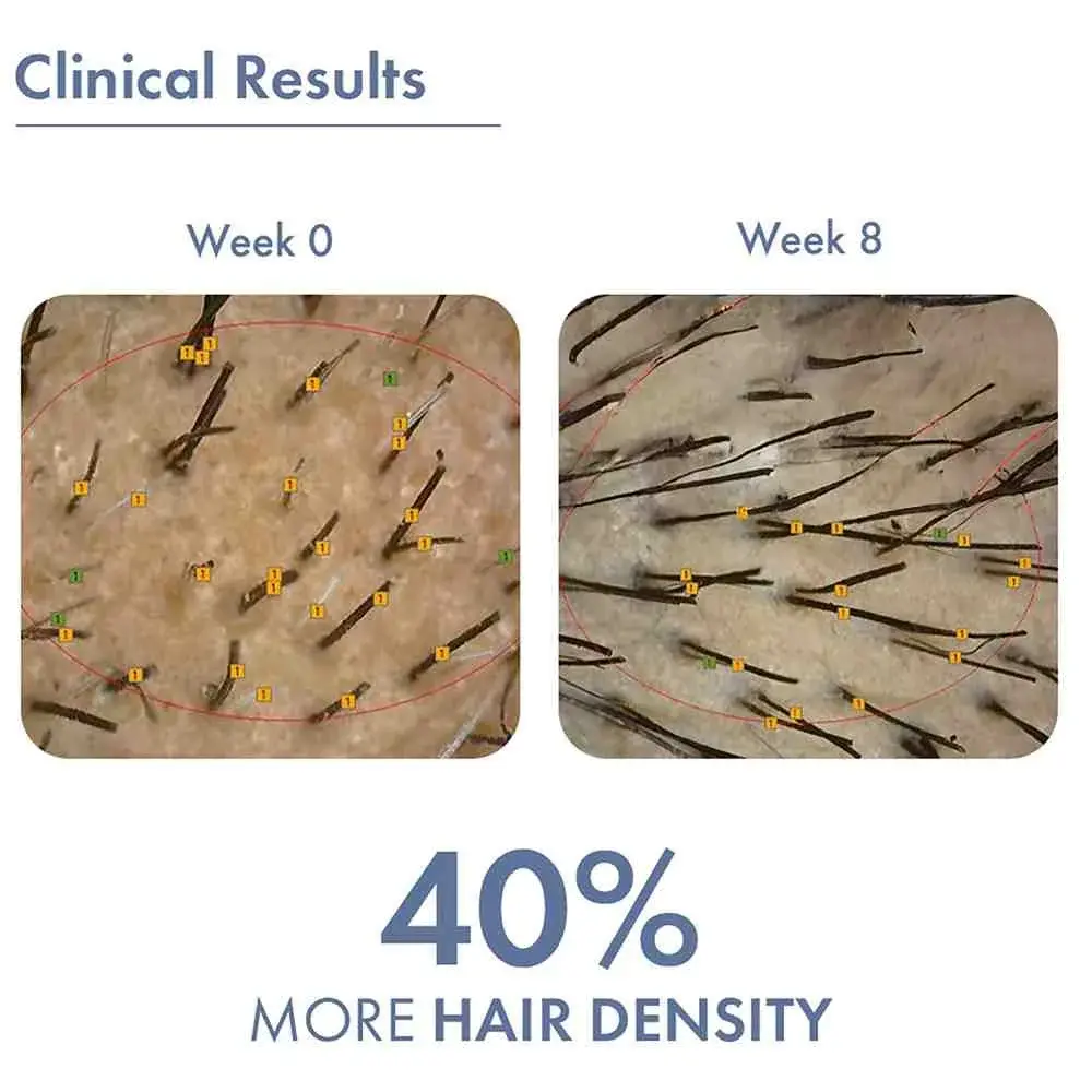 Hair Growth Serum 2.0 For Men & Women - Image 7