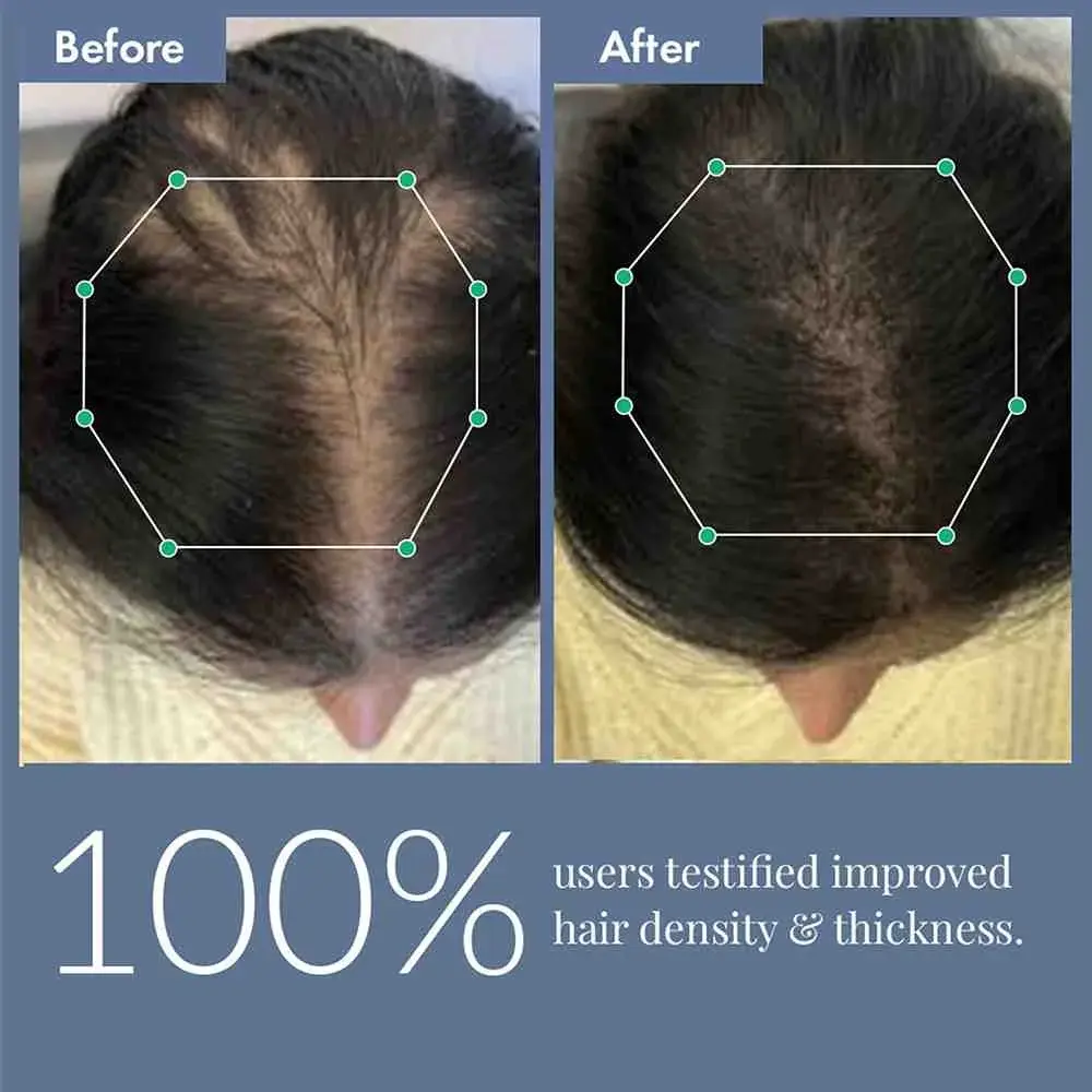 Hair Growth Serum, 50ml + Women's Hair Growth Supplement, 60N - Image 10
