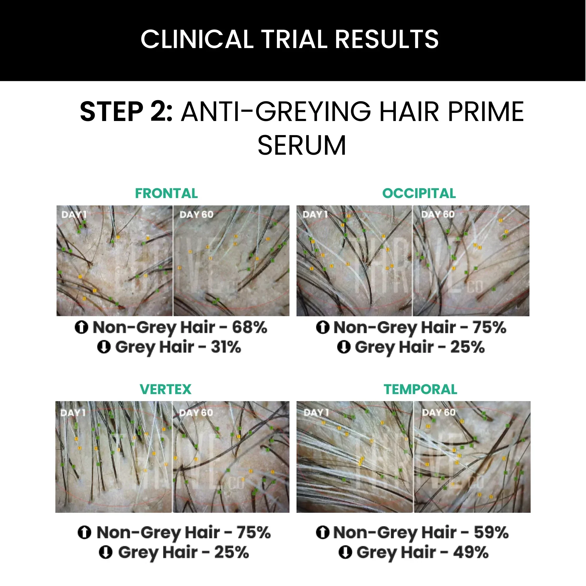 Hair Vitalizing Rosemary Shampoo (250ml) + ThriveCo Hair Prime Serum (50ml) - Image 4