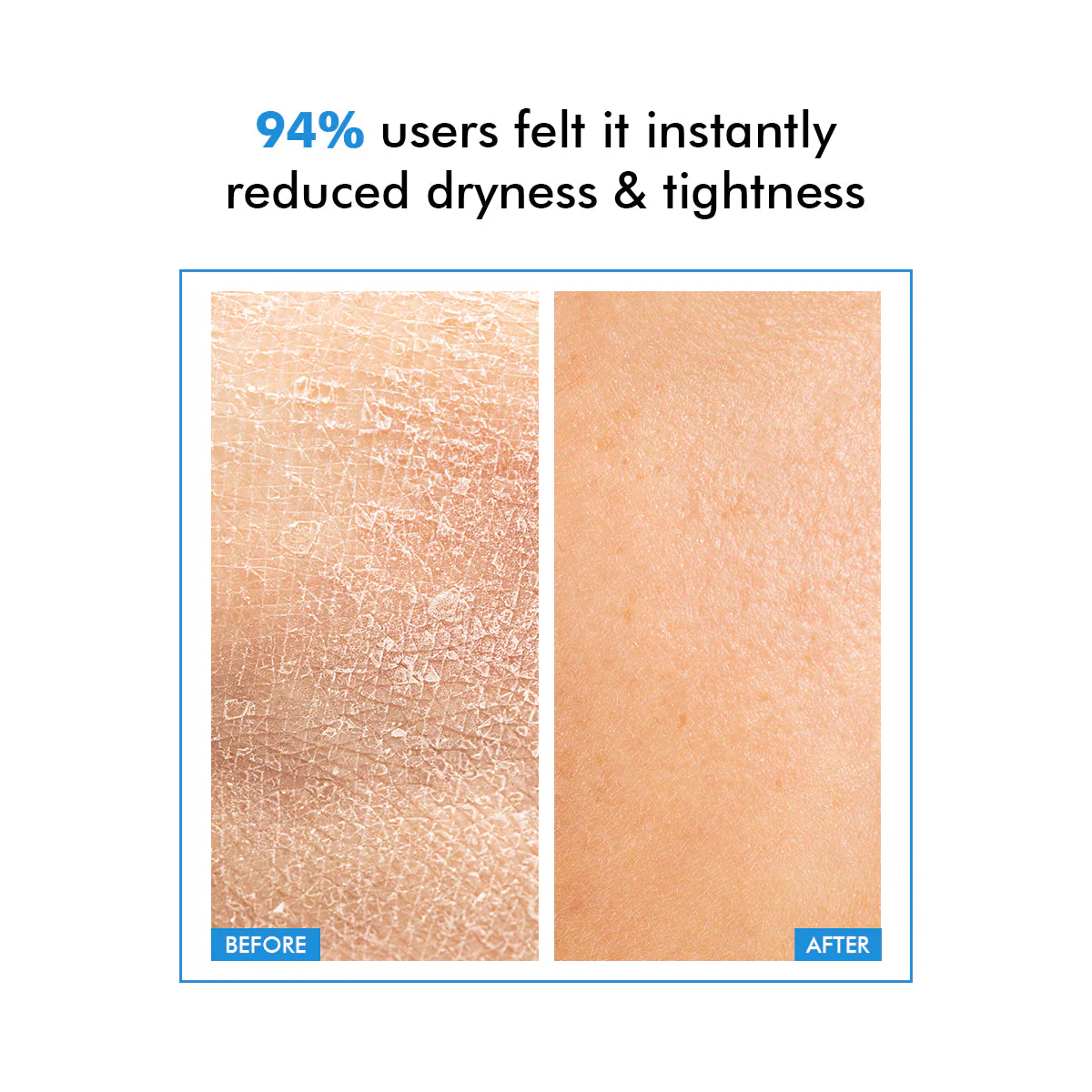 Hydro+ Hydrating & Plumping Serum | 1% Multi-Molecular Hyaluronic Acid | 30 ml | CK - Image 4