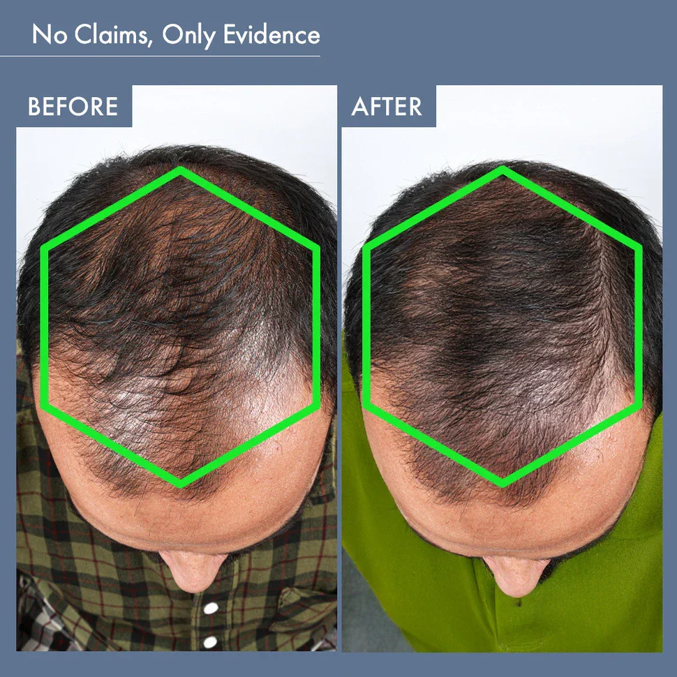 Men's Hair Growth Supplement, 60N Capsules - Image 8