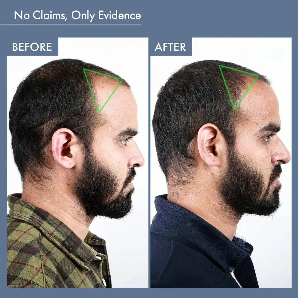 Men's Hair Growth Supplement, 60N Capsules - Image 6