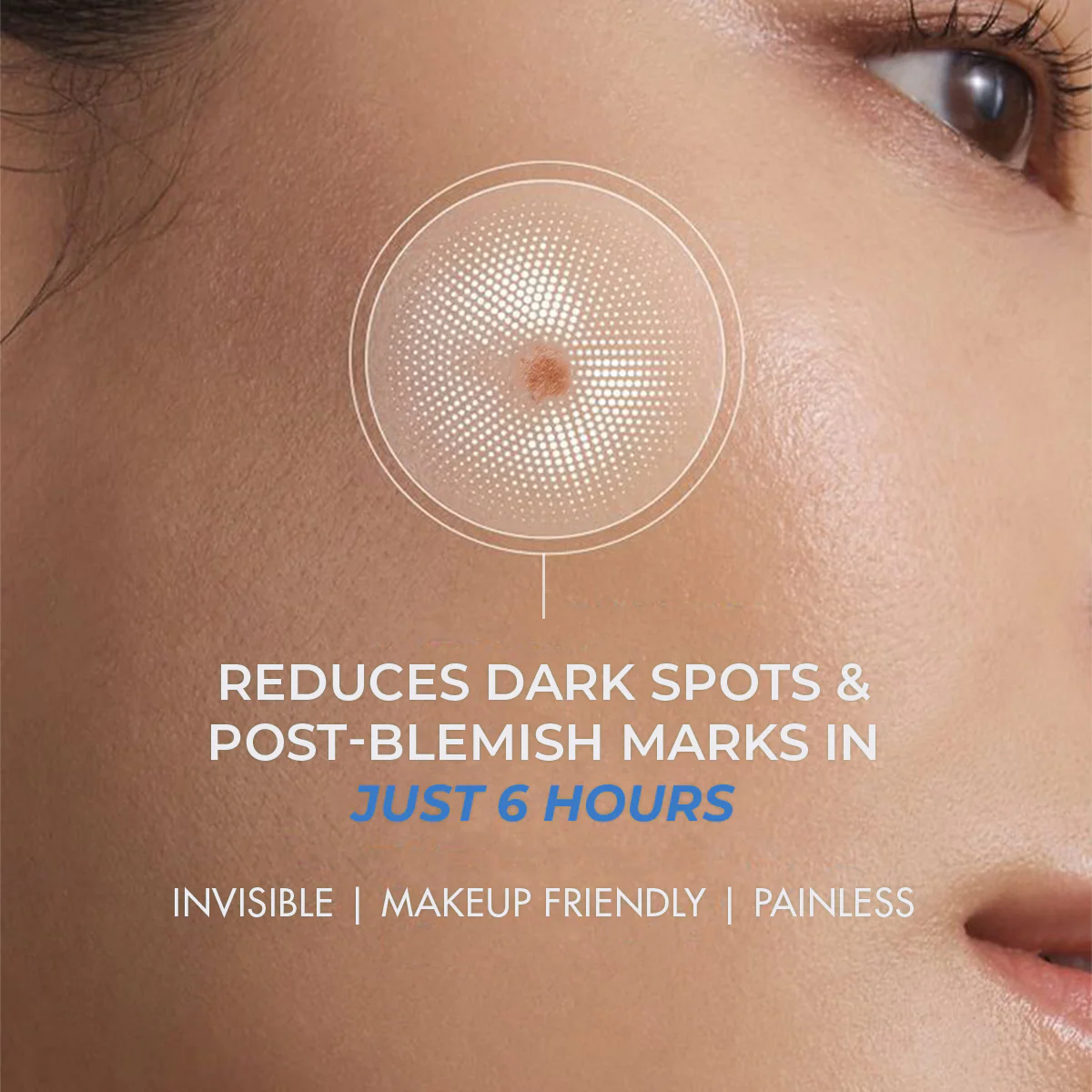 Microneedle Patch For Dark Spot Removal | 4 Patches | CK - Image 2