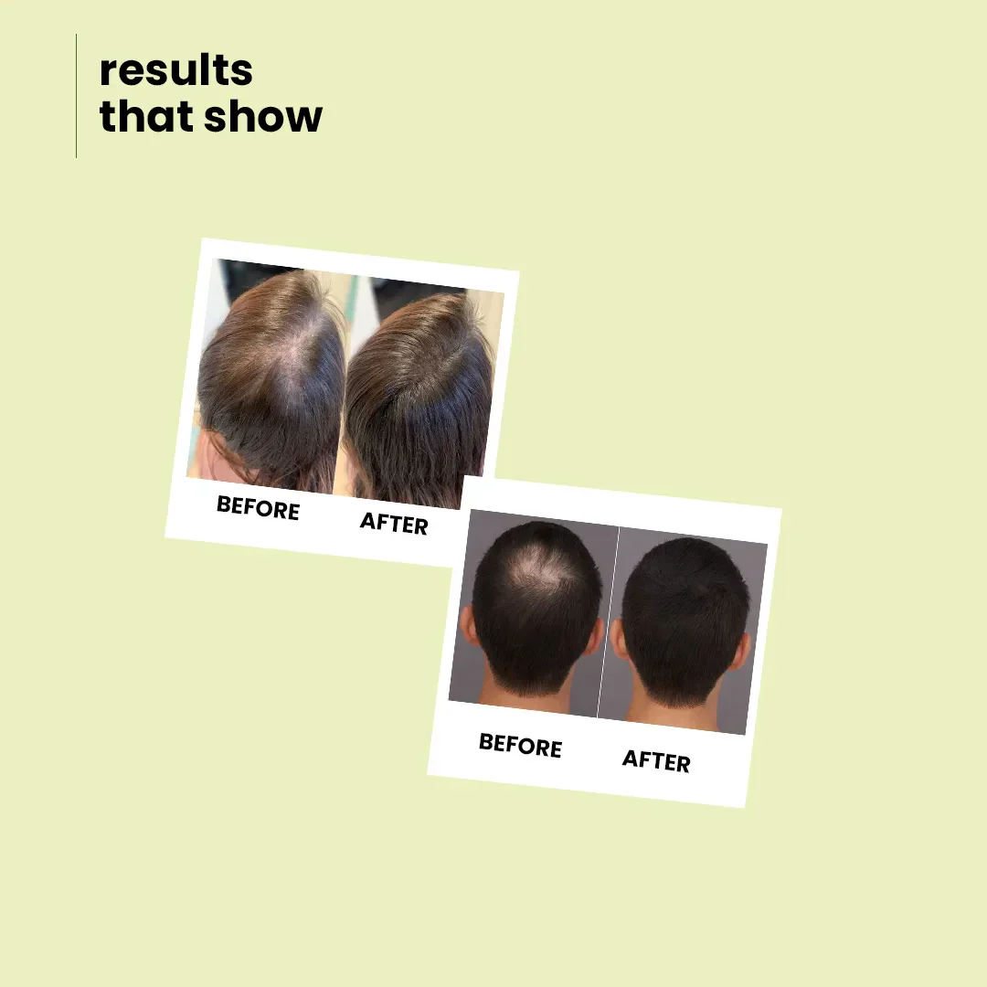 Moroccan Argan & Apple Cider Shampoo | Deep Moisturization, Smooth & Lustrous Hair 200 ml - Image 7