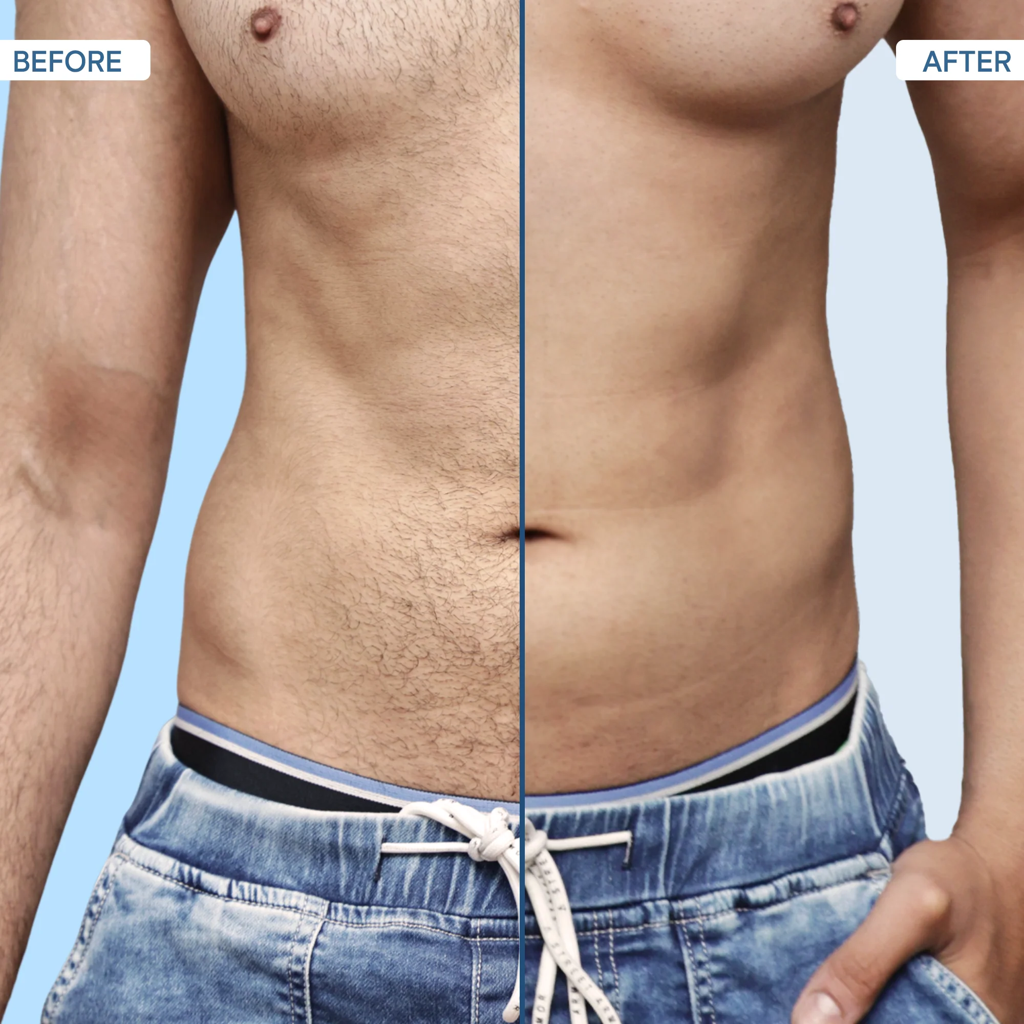 Nut Groomer 2.0 - Image 11
