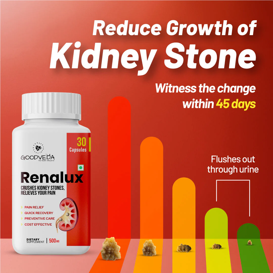 Renalux #1 ayurvedic formula for a stone free life, Naturally Best results in 45 days. (Holi Sale) - Image 3