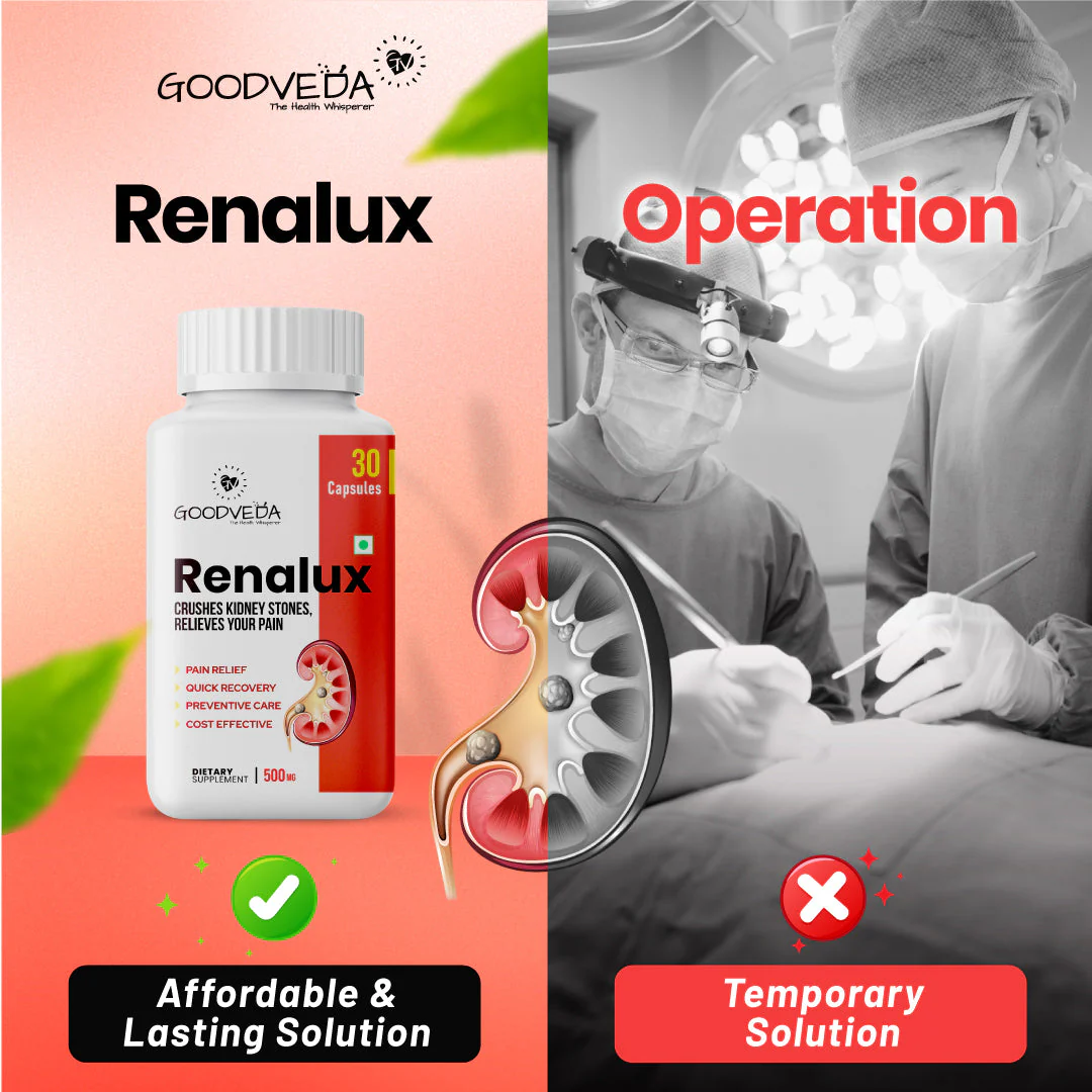 Renalux #1 ayurvedic formula for a stone free life, Naturally Best results in 45 days. (Holi Sale) - Image 4
