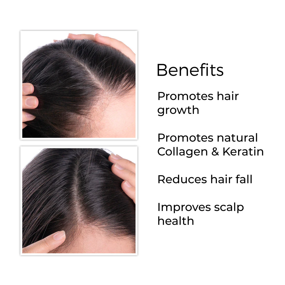 Root Deep Complete Scalp Food For Hair Fall Reduction, Hair Strengthening & Essential Nutrition (90 Day Supply) - Image 3
