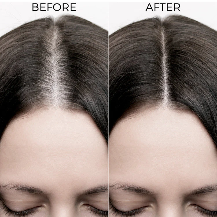 Rosemary Oil Shots (2 Pack) with Shampoo For Visible Hair Growth - Image 11