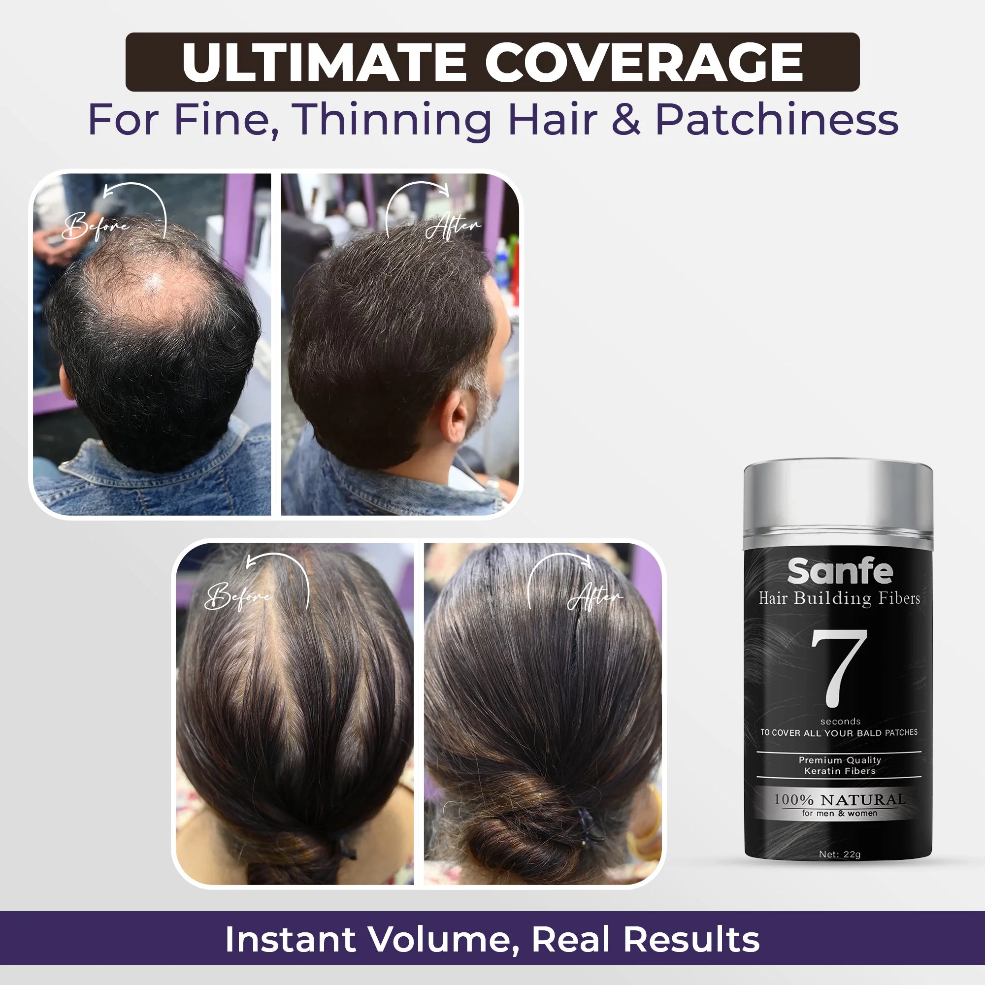 Sanfe 10-Second Hair Transformation Combo - Image 5