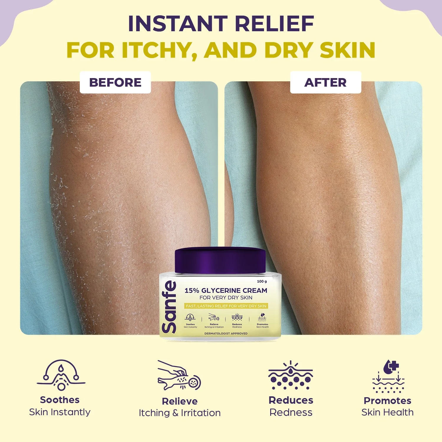 Sanfe 15% Glycerine Cream- 100gm - Image 2