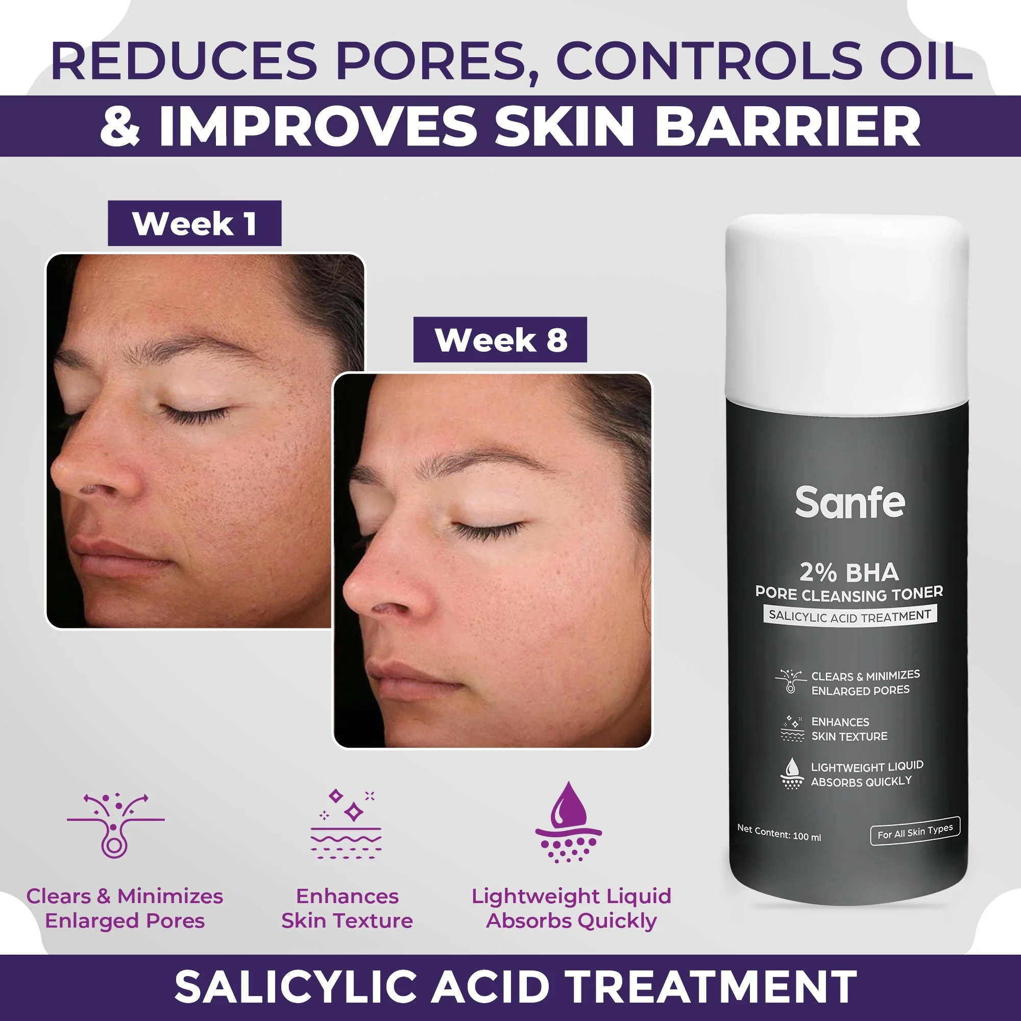 Sanfe 2% BHA Pore Cleansing Toner - 100ml - Image 2
