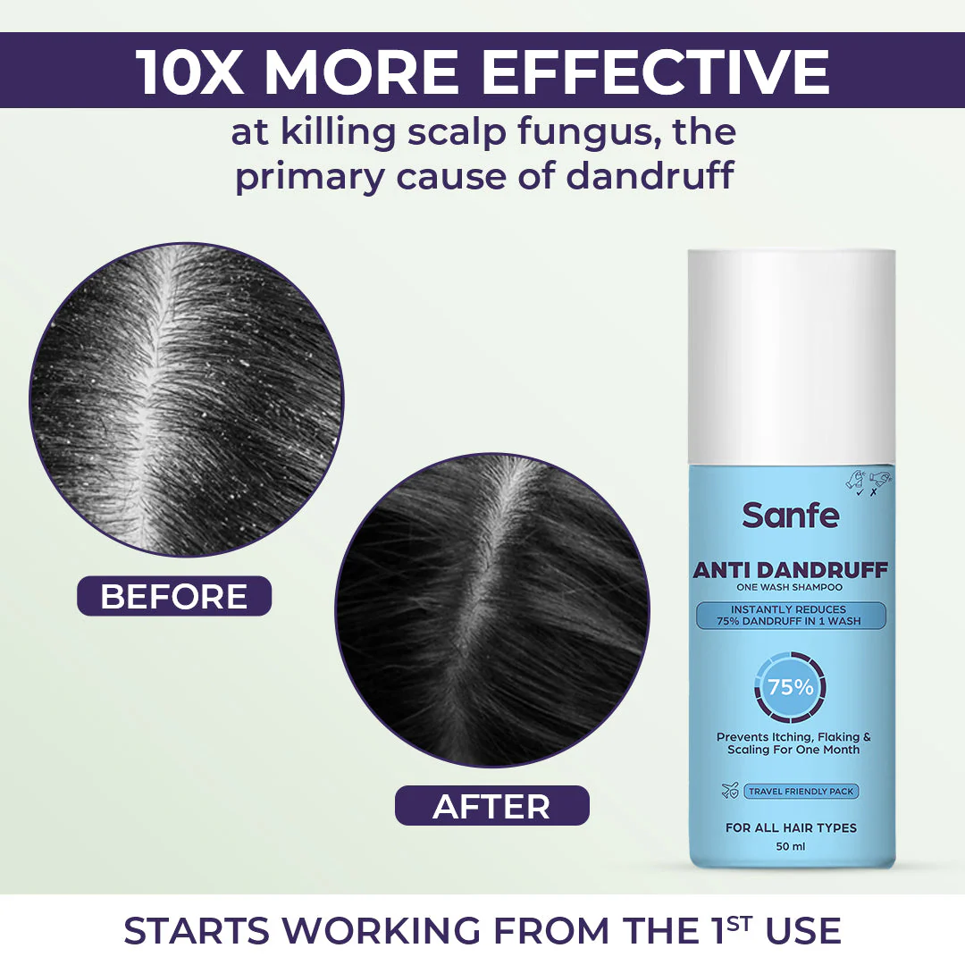Sanfe Anti Dandruff One Wash Shampoo Removes Dandruff, Helps With Itching & Irritation 50ml - Image 2