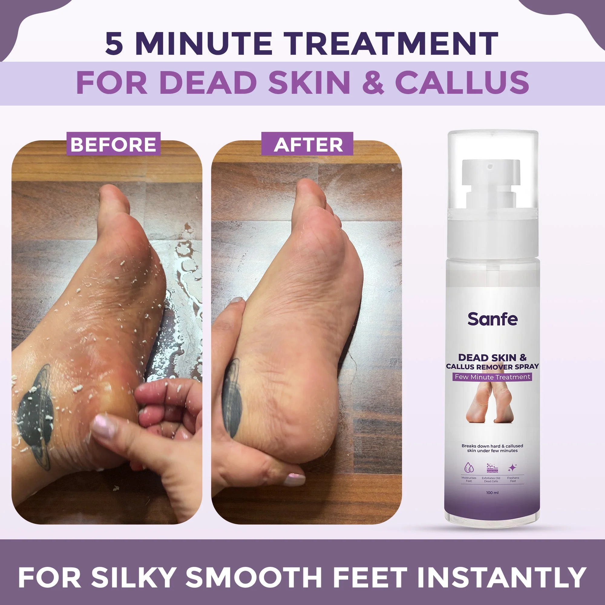 Sanfe Dead Skin & Callus Remover Spray - 100ml - Image 3