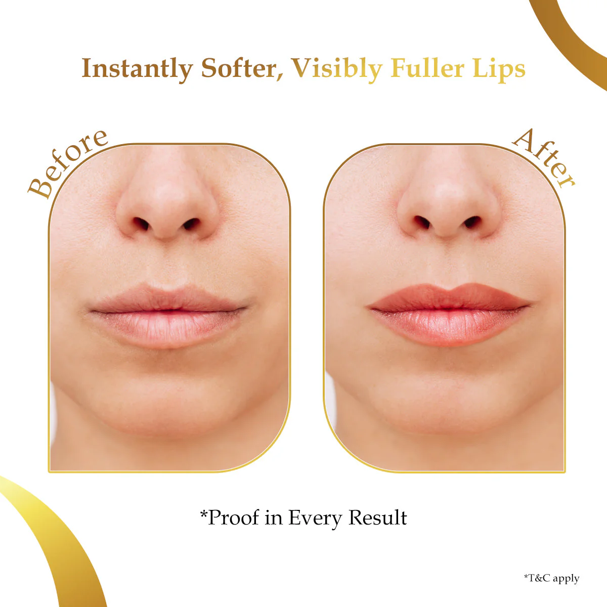 Sanfe Hydrogel Lip Mask - Image 3