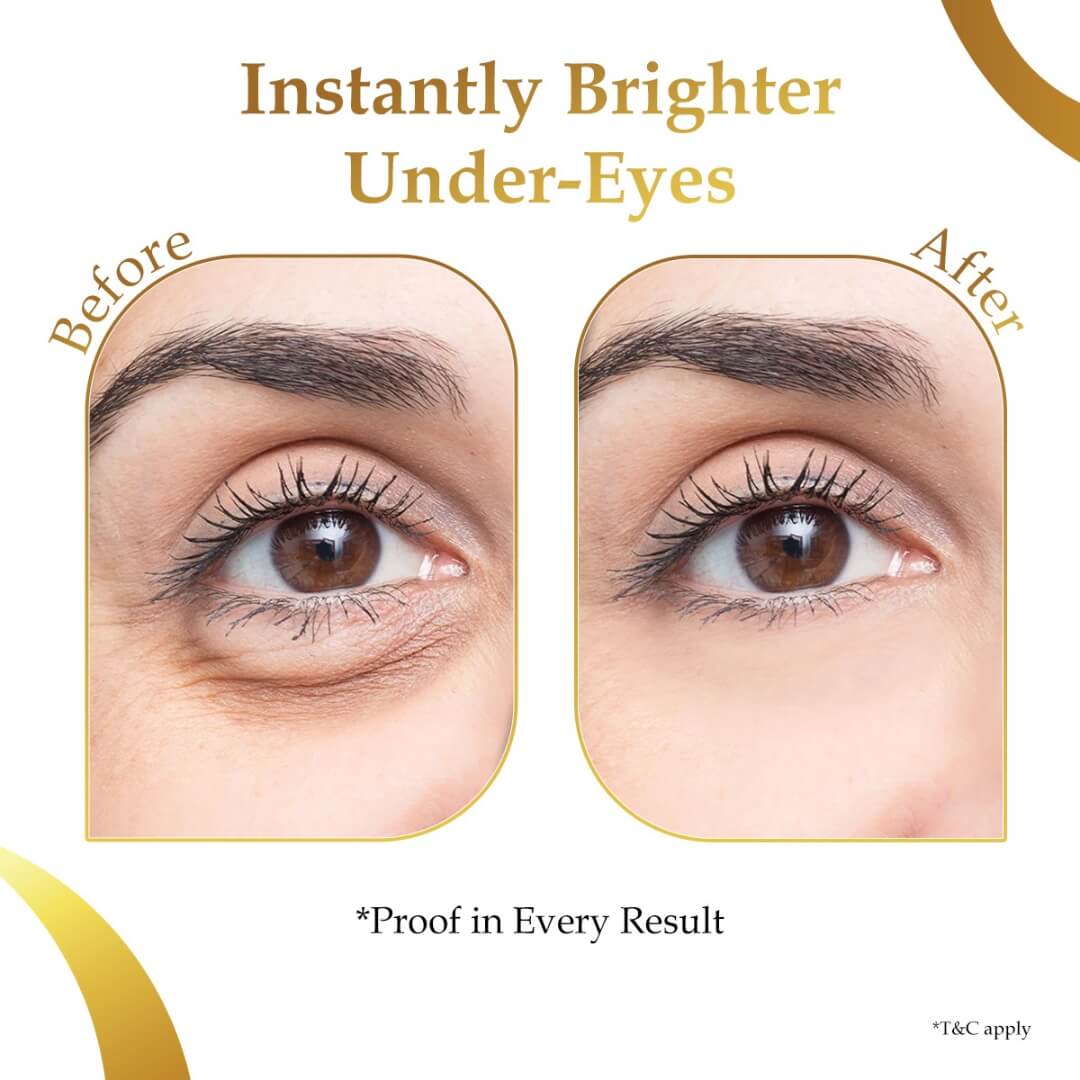 Sanfe Hydrogel Under Eye Patches (Pack of 6) - Image 7