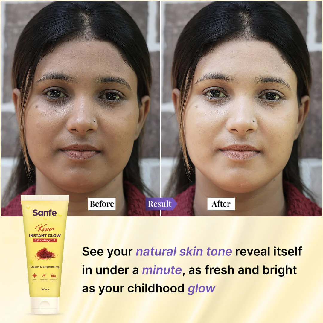 Sanfe Kesar Instant Glow Exfoliating Gel - 200gm - Image 5