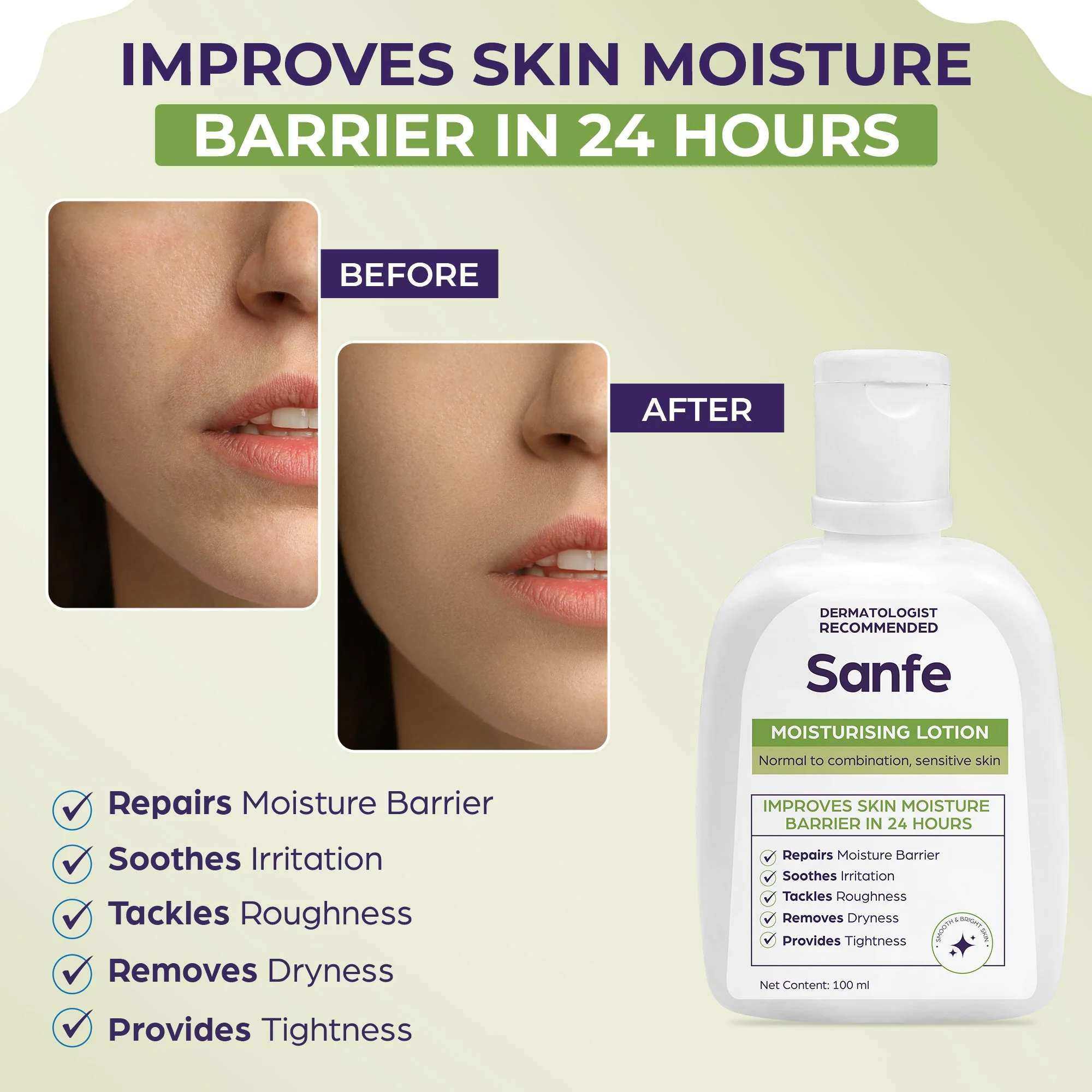 Sanfe Moisturizing Lotion - 100ml - Image 2