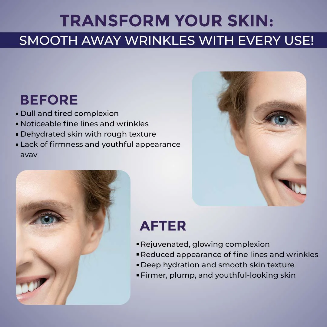 Sanfe Mummy Anti Wrinkle & Lifting Face Mask - Image 2