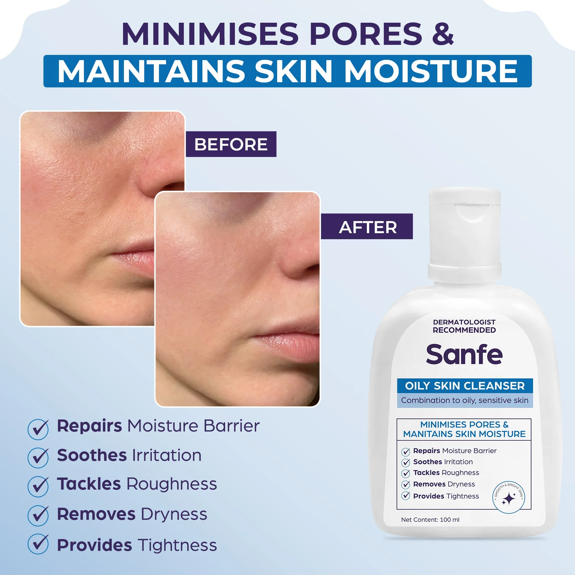 Sanfe Oily Skin Cleanser - 100ml - Image 2