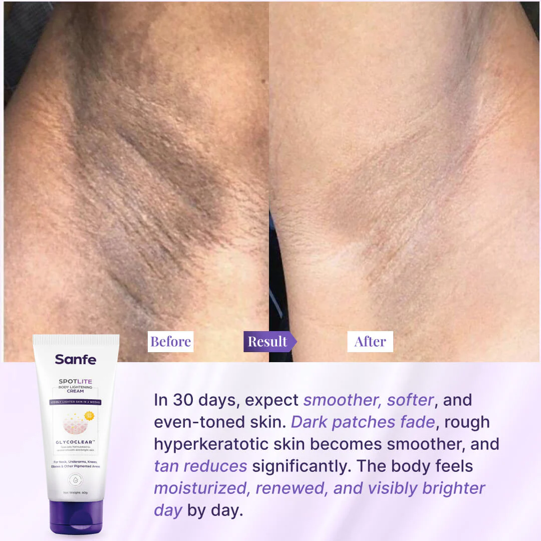 Spotlite Body Lightening Cream - Image 5