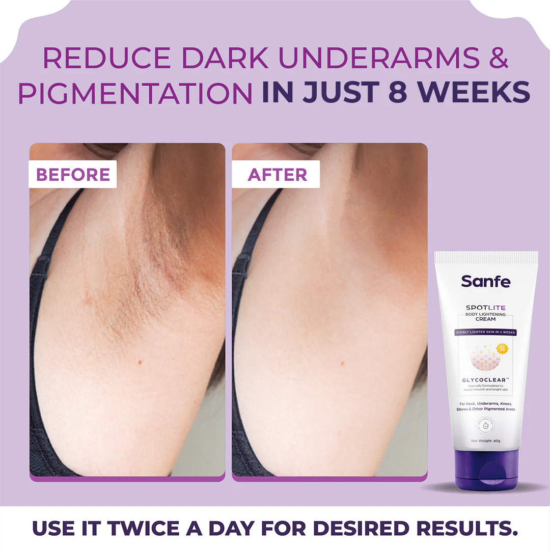 Spotlite Body Lightening Cream - Pack of 2 - Image 3
