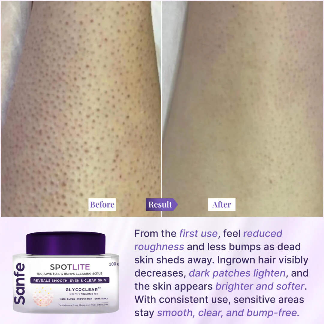 Spotlite Sensitive Areas Body Scrub - Image 5