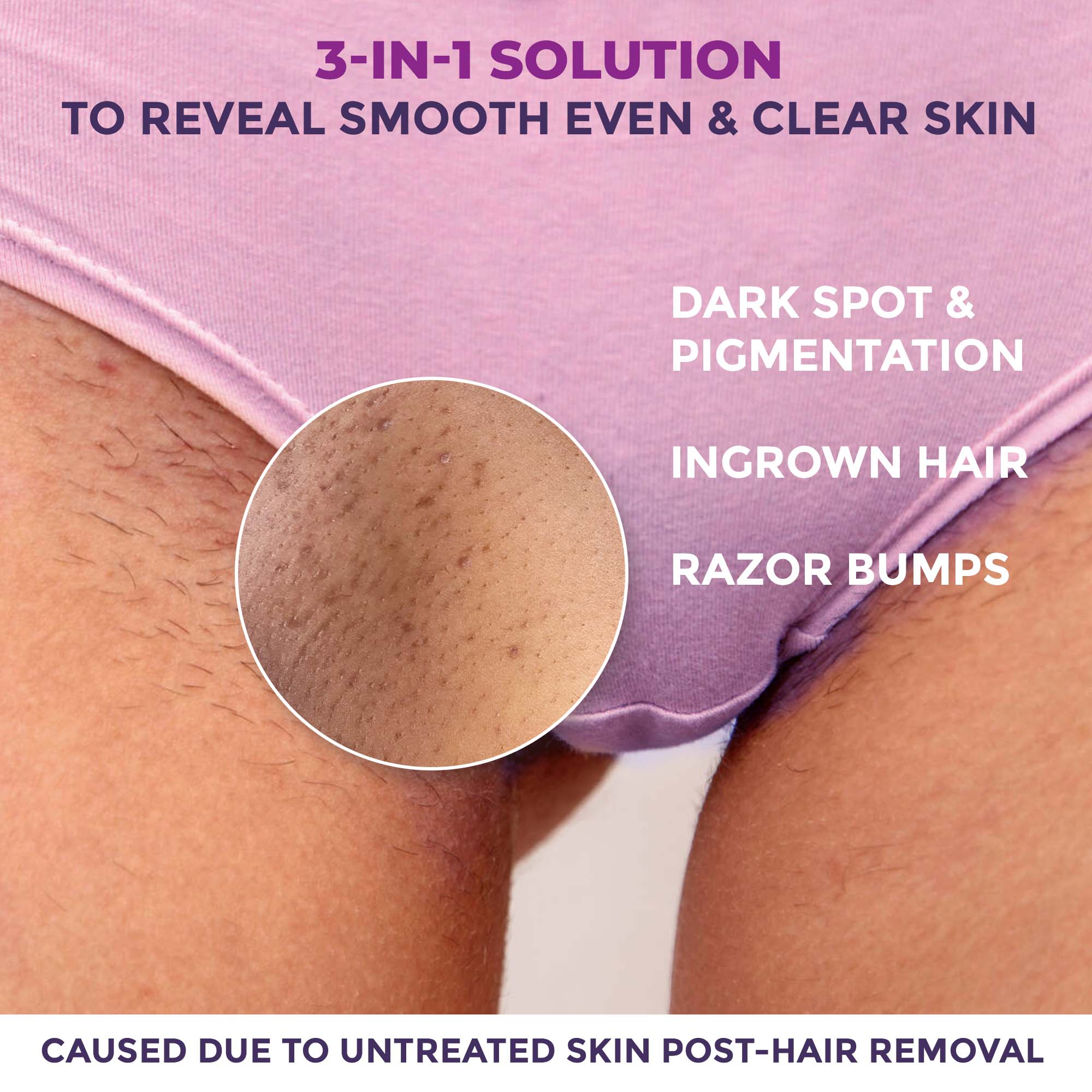 Spotlite Sensitive Areas Body Scrub - Image 2