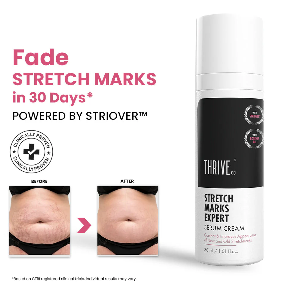 Stretch Marks Expert, Serum Cream, 30 ml - Image 2
